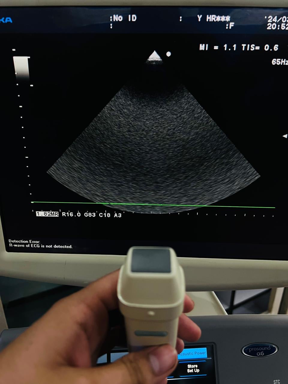 ..Aloka UST-5299 cardiac probe