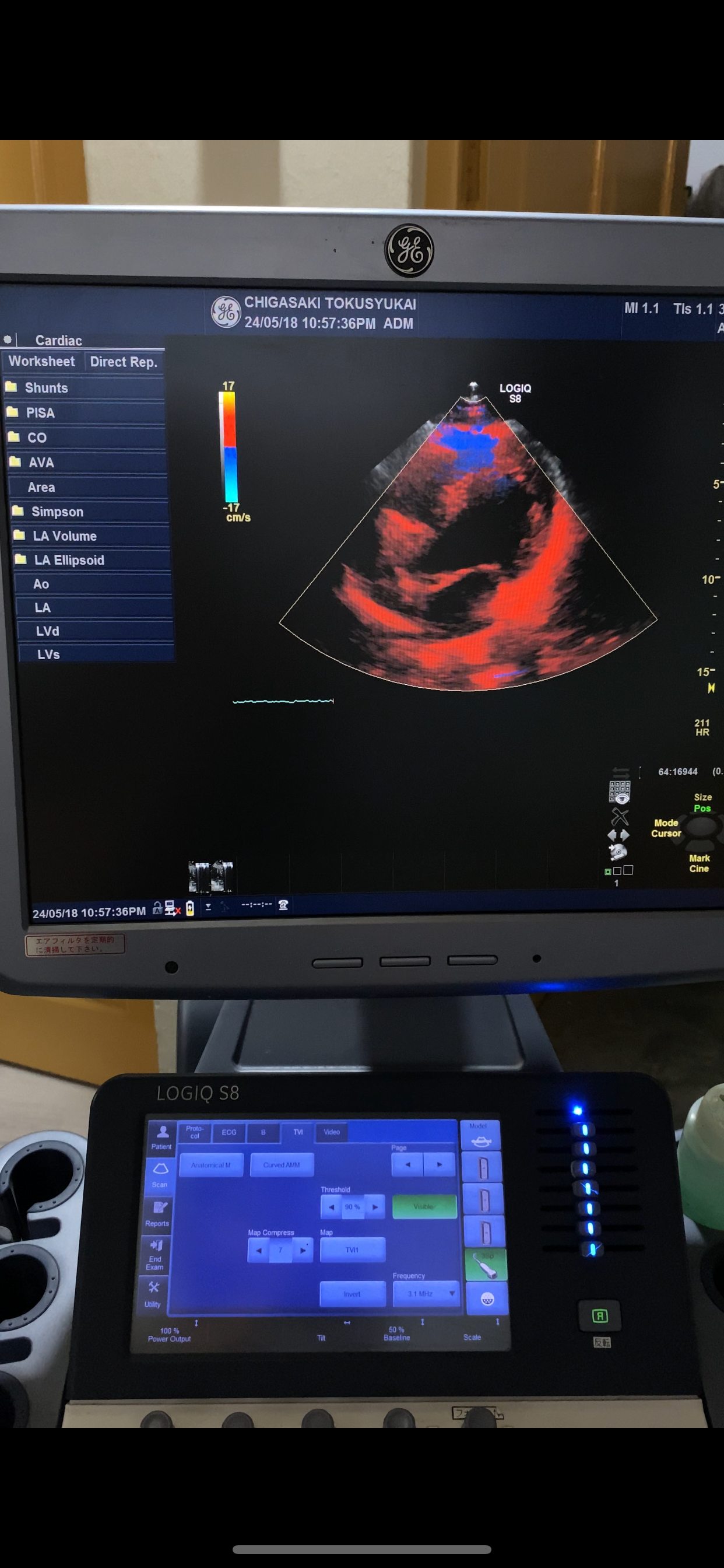 …GE 3SP-D cardiac probe