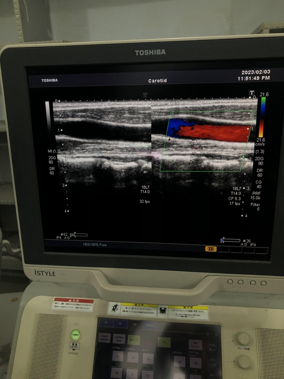 Toshiba PLT-1204BT linear probe - Japan Medical Company LTD