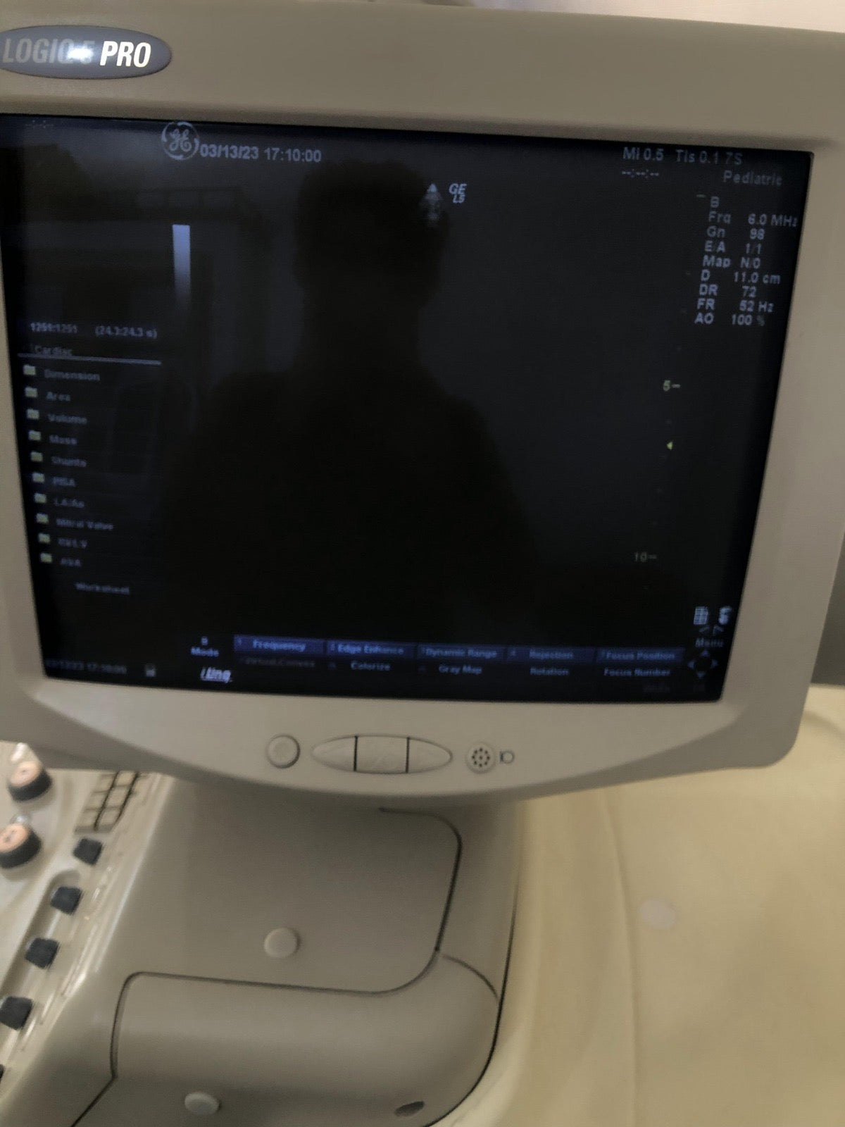 ..GE 7S cardiac probe - Japan Medical Company LTD