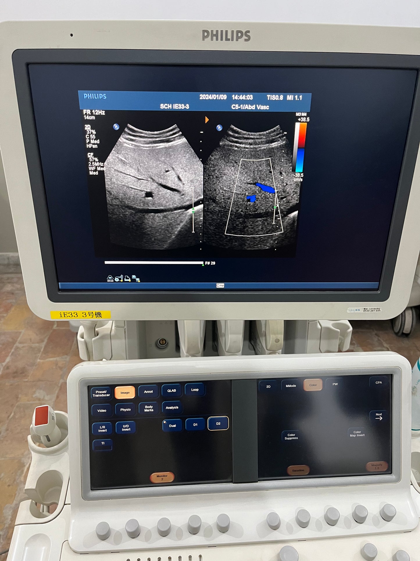 Phillips IE33 Dedicated Echocardiography - Japan Medical Company LTD