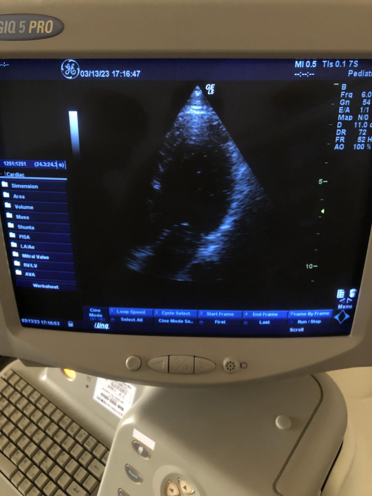 ..GE 7S cardiac probe - Japan Medical Company LTD