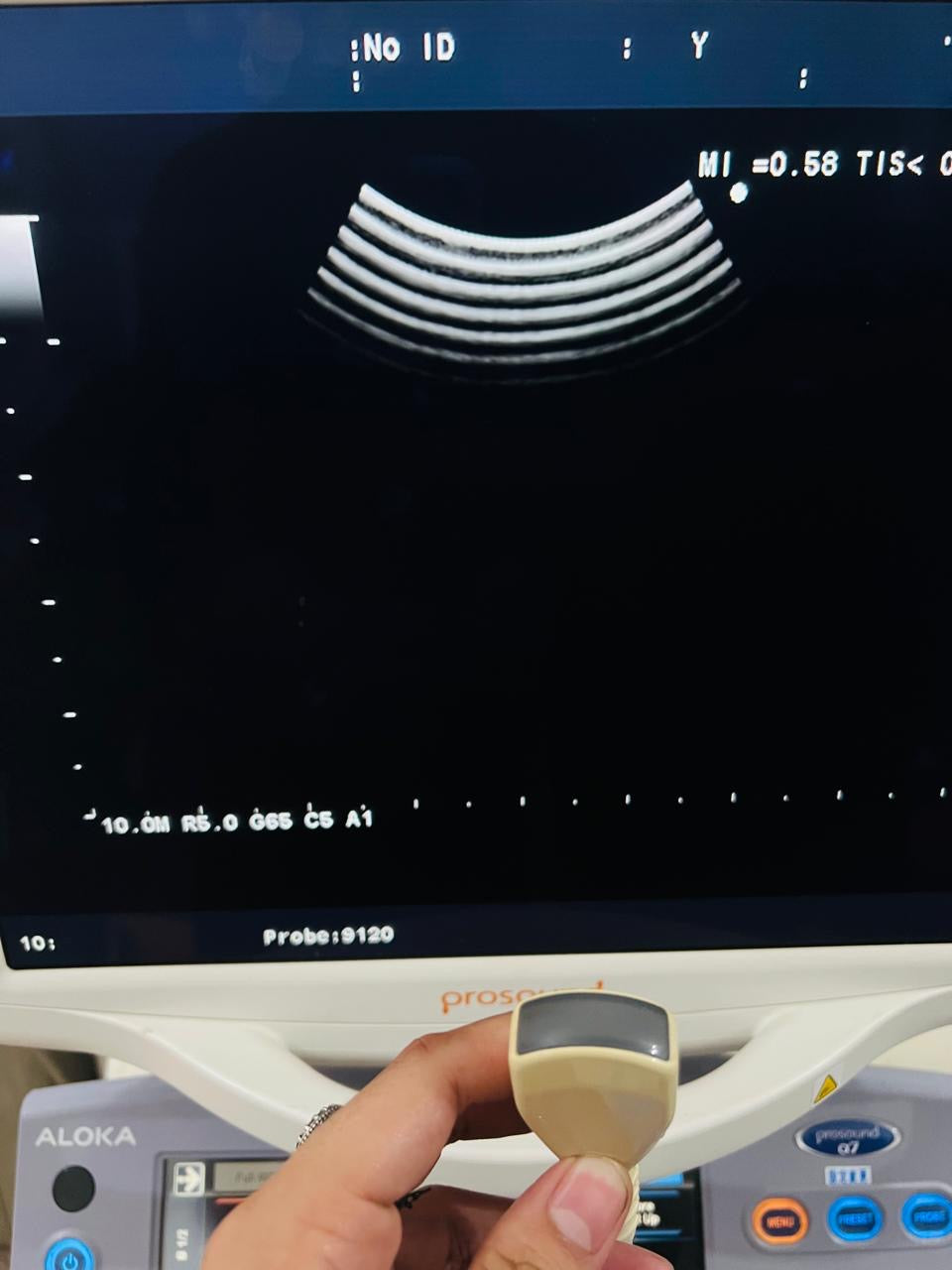 ..Aloka UST-9120 microconvex probe
