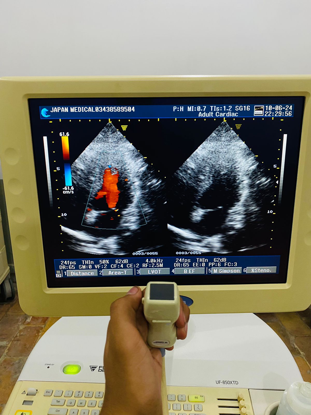 Z…Fukuda Denshi 2-5 cardiac probe