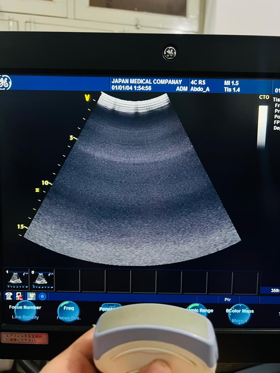 GE 4C RS Probe num 9