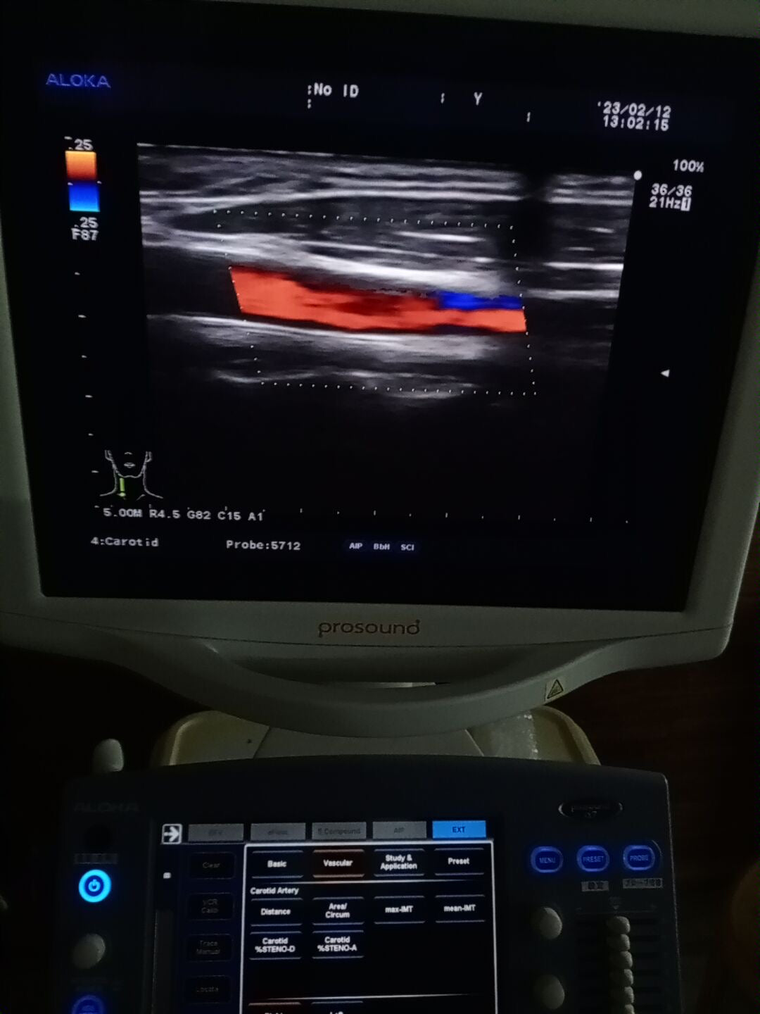 ..Hitachi UST-5712 linear vascular probe - Japan Medical Company LTD