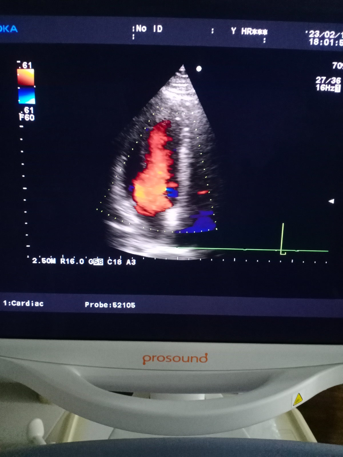 ..Aloka UST-52105 cardiac probe - Japan Medical Company LTD