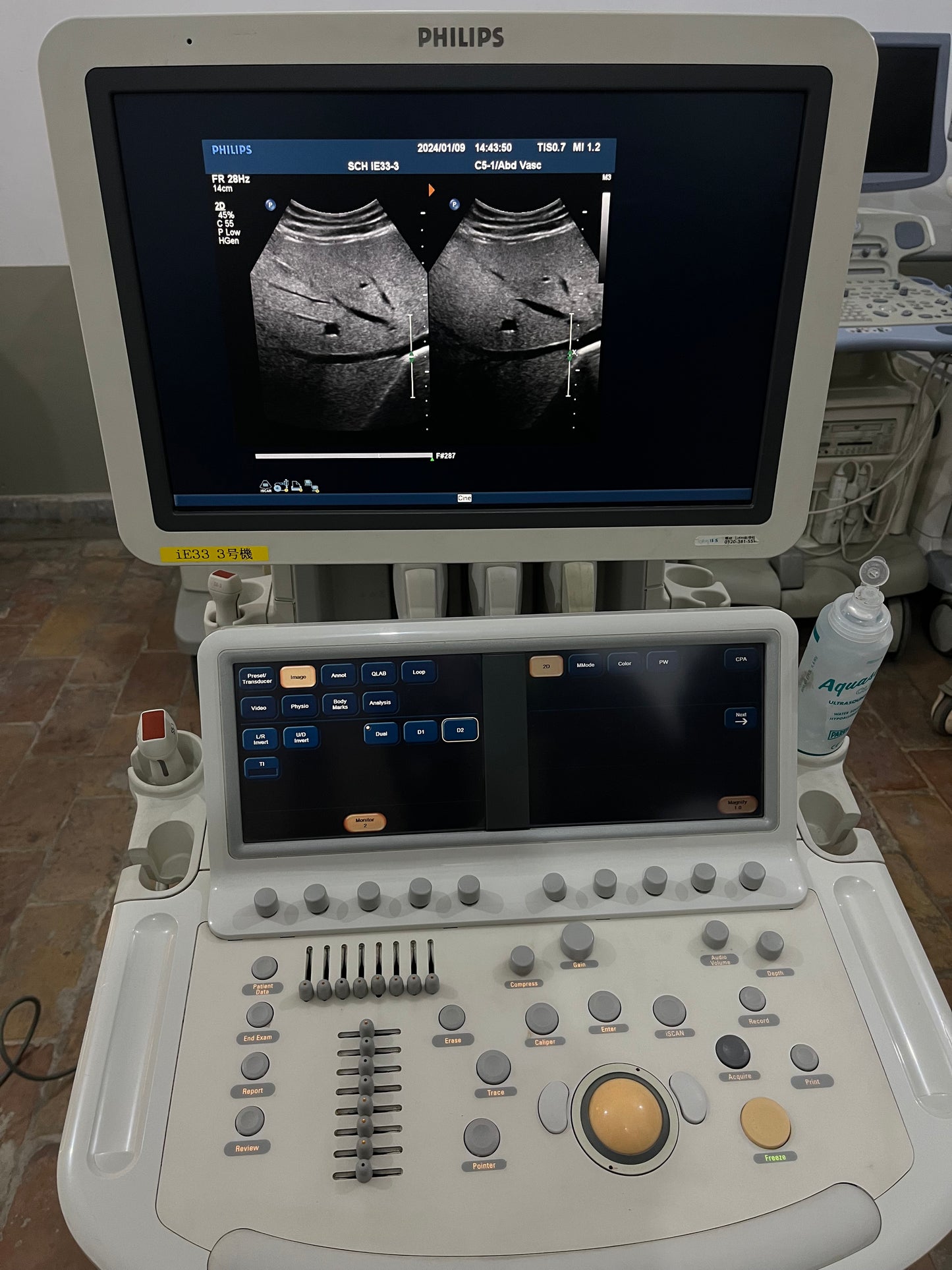 Phillips IE33 Dedicated Echocardiography - Japan Medical Company LTD