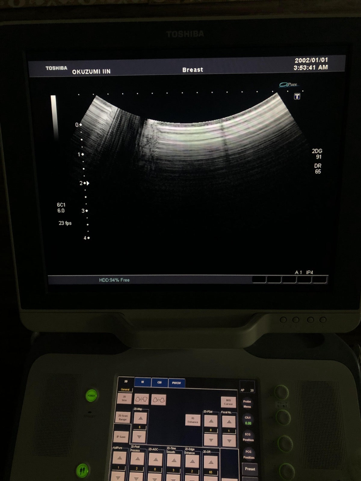 Toshiba PVT-375BT Canvex probe - Japan Medical Company LTD