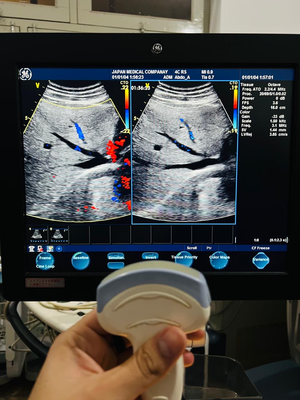 GE 4C RS Probe num 9