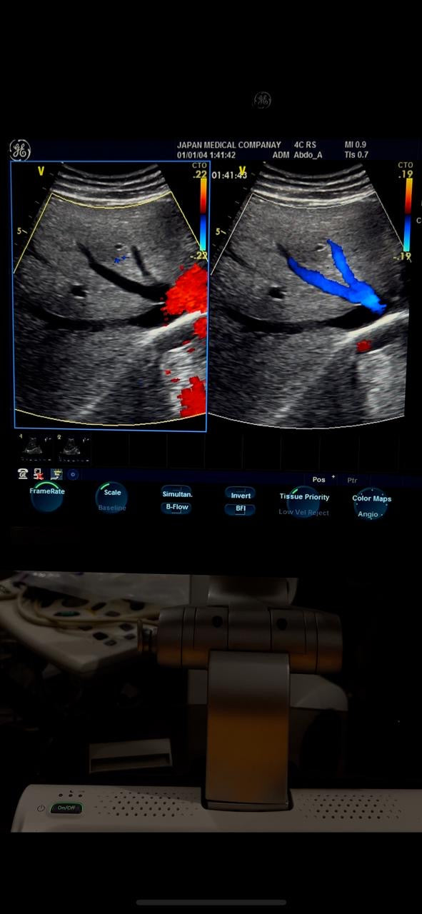 ..GE 4C RS Probe num 6