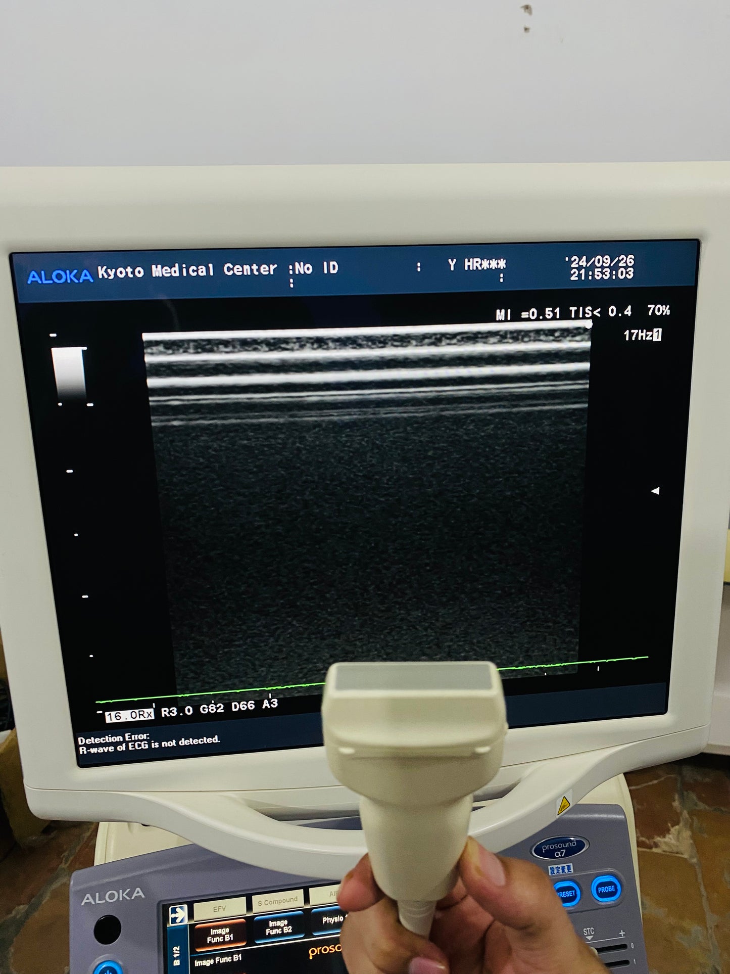 P..Aloka UST-5412 linear probe