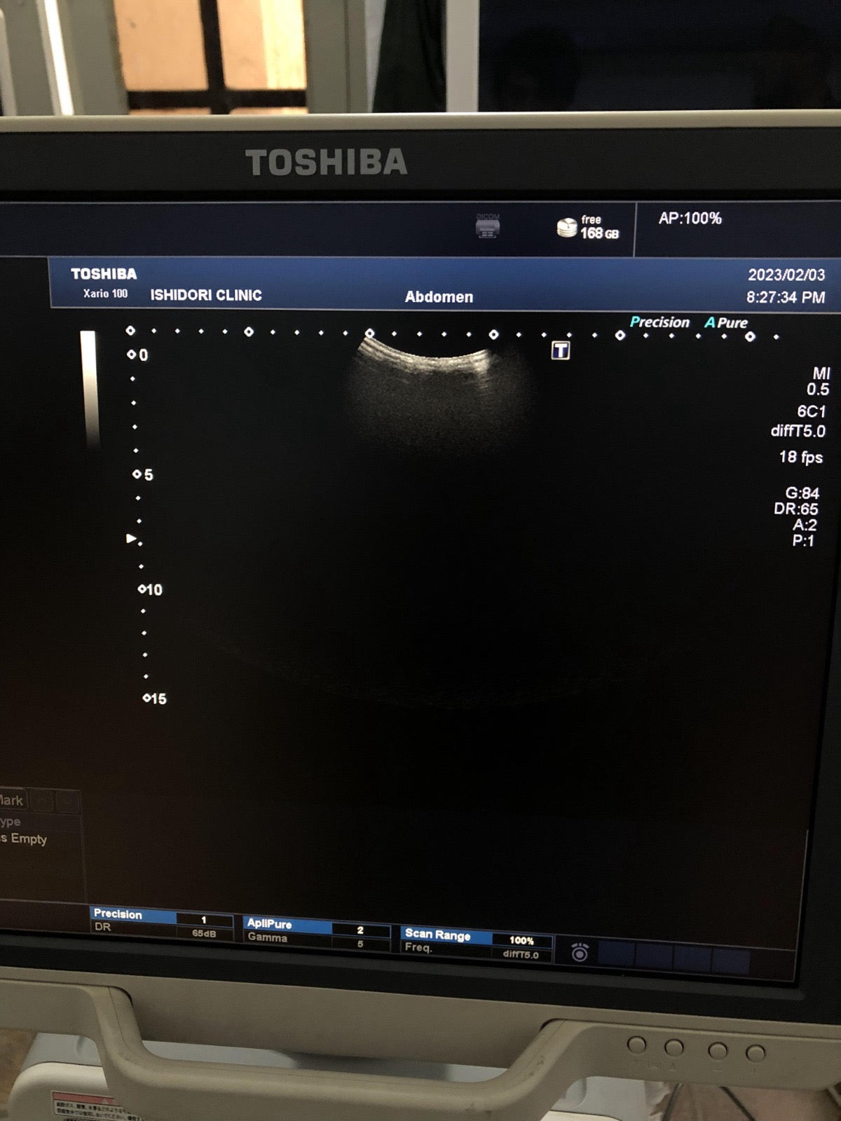 Toshiba PVU-375BT canvex probe - Japan Medical Company LTD
