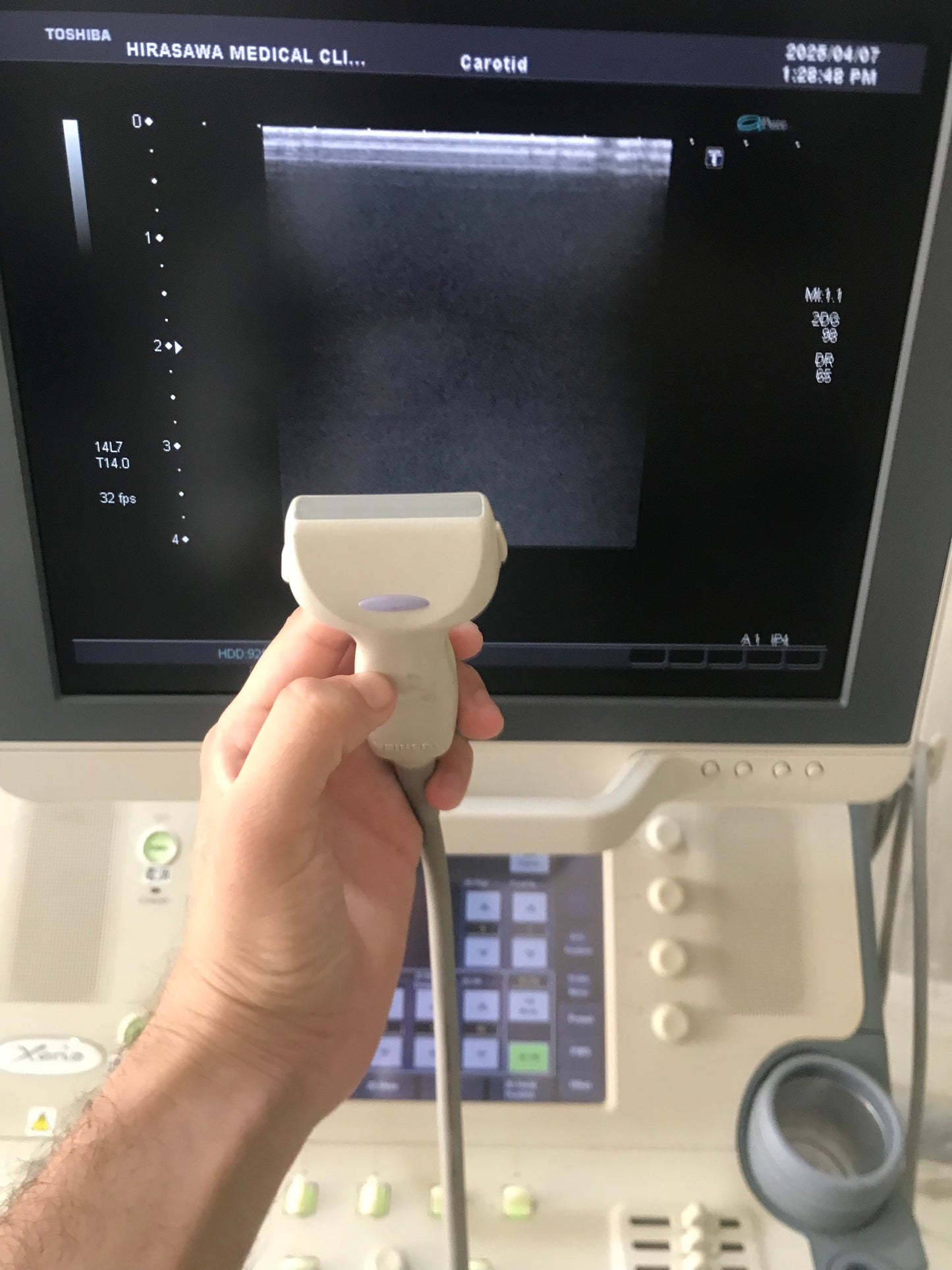 P..Toshiba PLT-1204AT linear probe