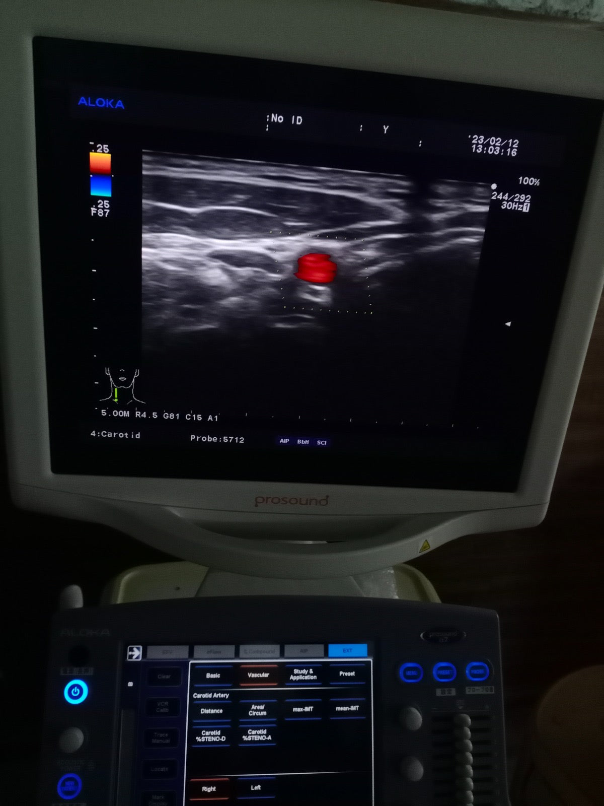 ..Hitachi UST-5712 linear vascular probe - Japan Medical Company LTD