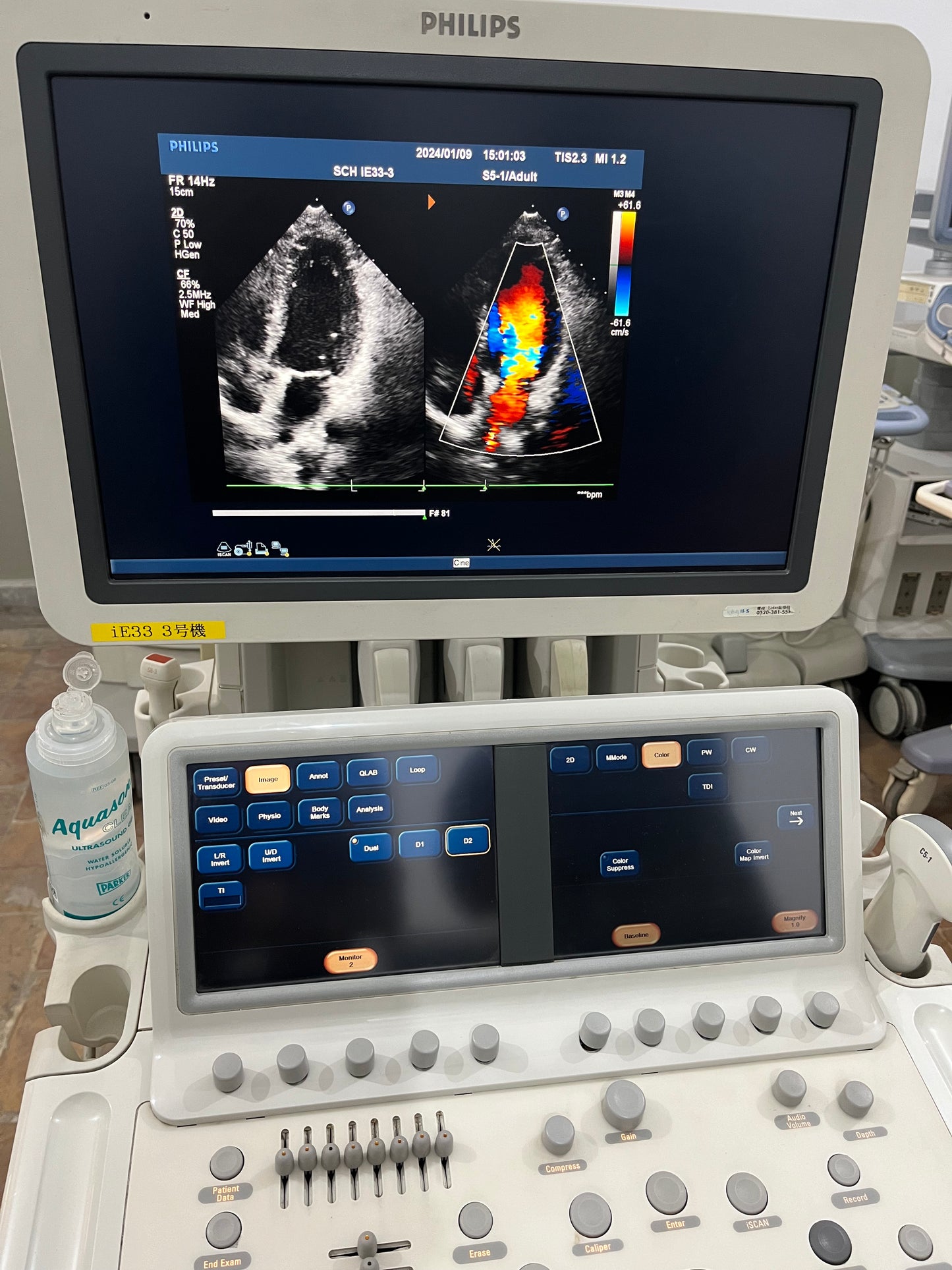 Phillips IE33 Dedicated Echocardiography - Japan Medical Company LTD