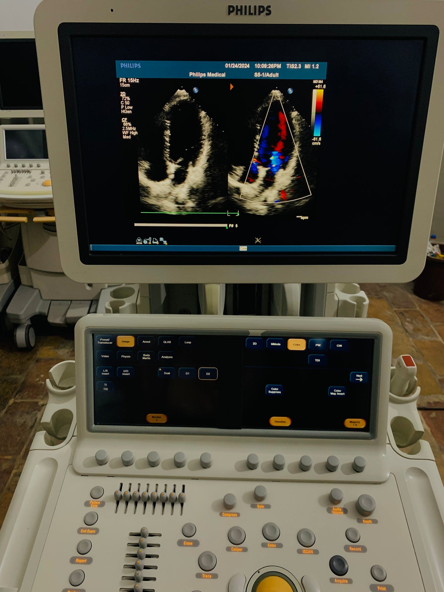 Philips IE 33 Ultrasound Machine
