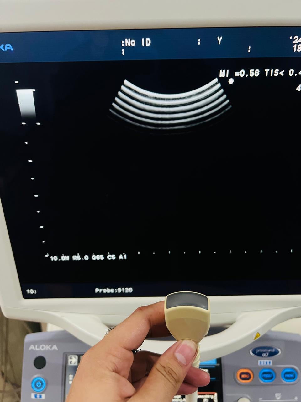 ..Aloka UST-9120 microconvex probe