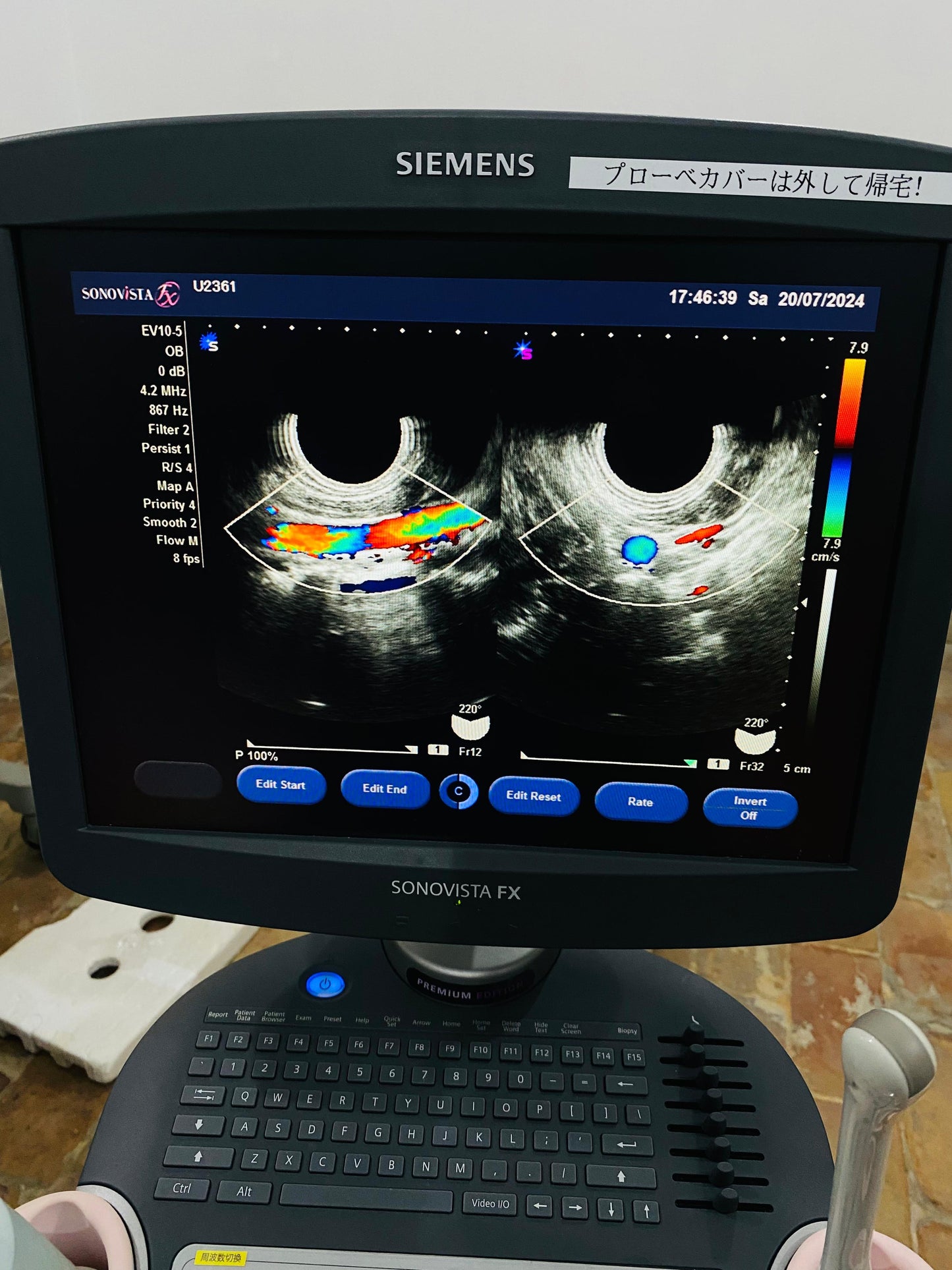P..Siemens EV10-5 Tvs probe