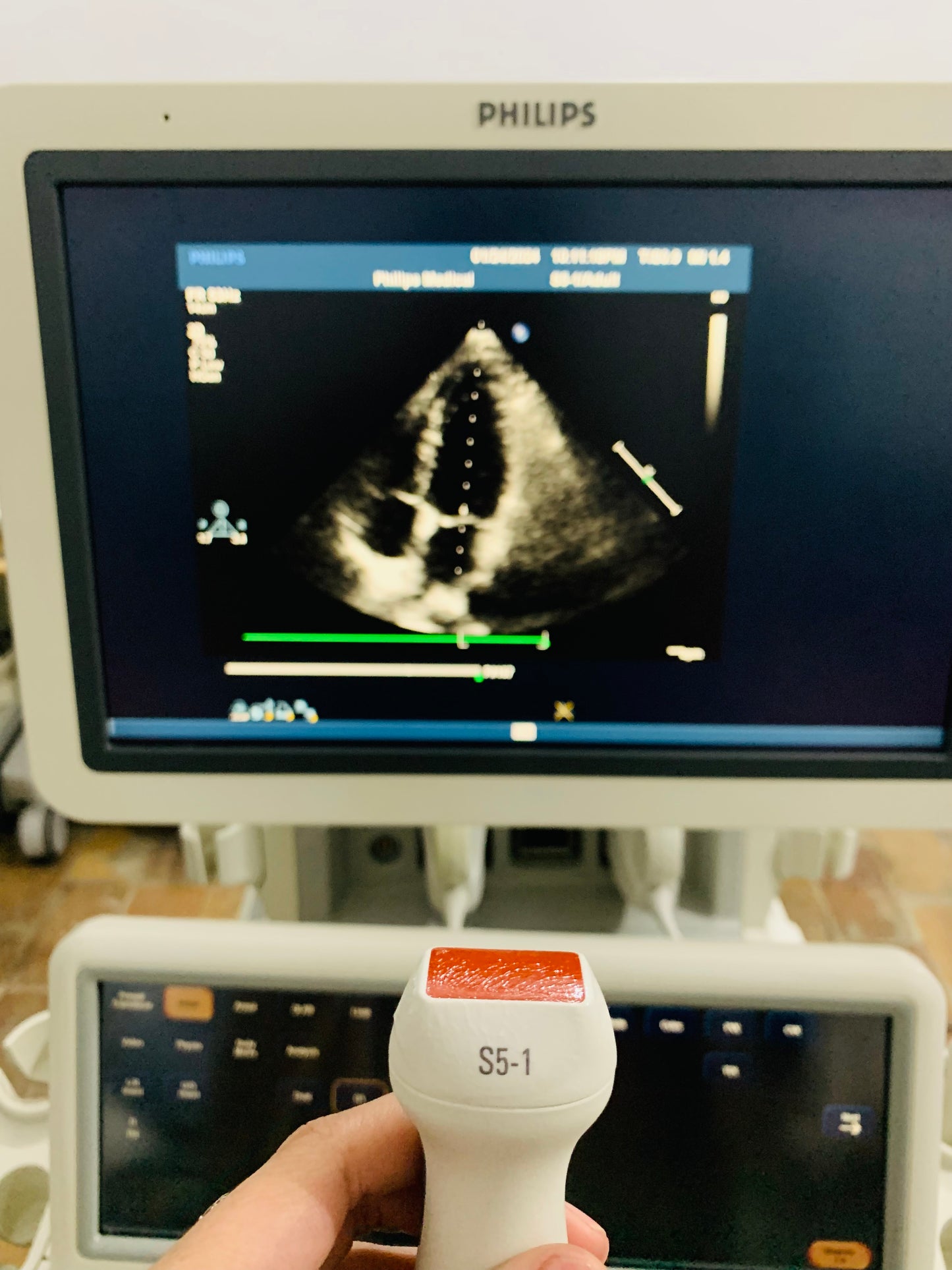 Philips IE 33 Ultrasound Machine