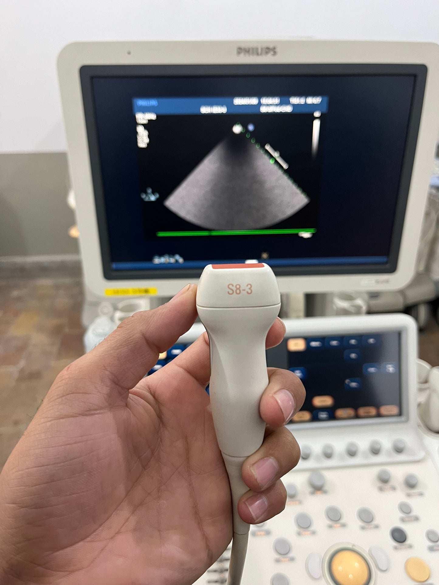Phillips IE33 Dedicated Echocardiography - Japan Medical Company LTD