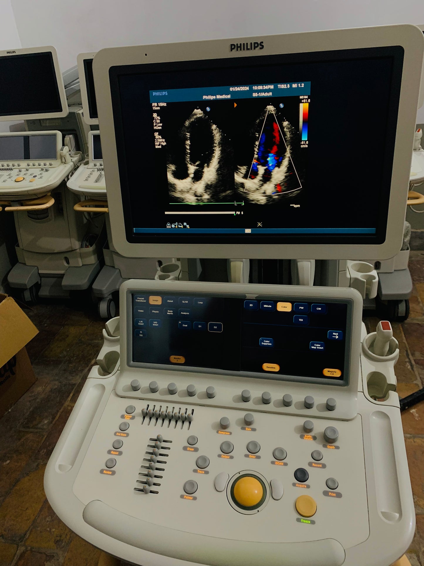 Philips IE 33 Ultrasound Machine