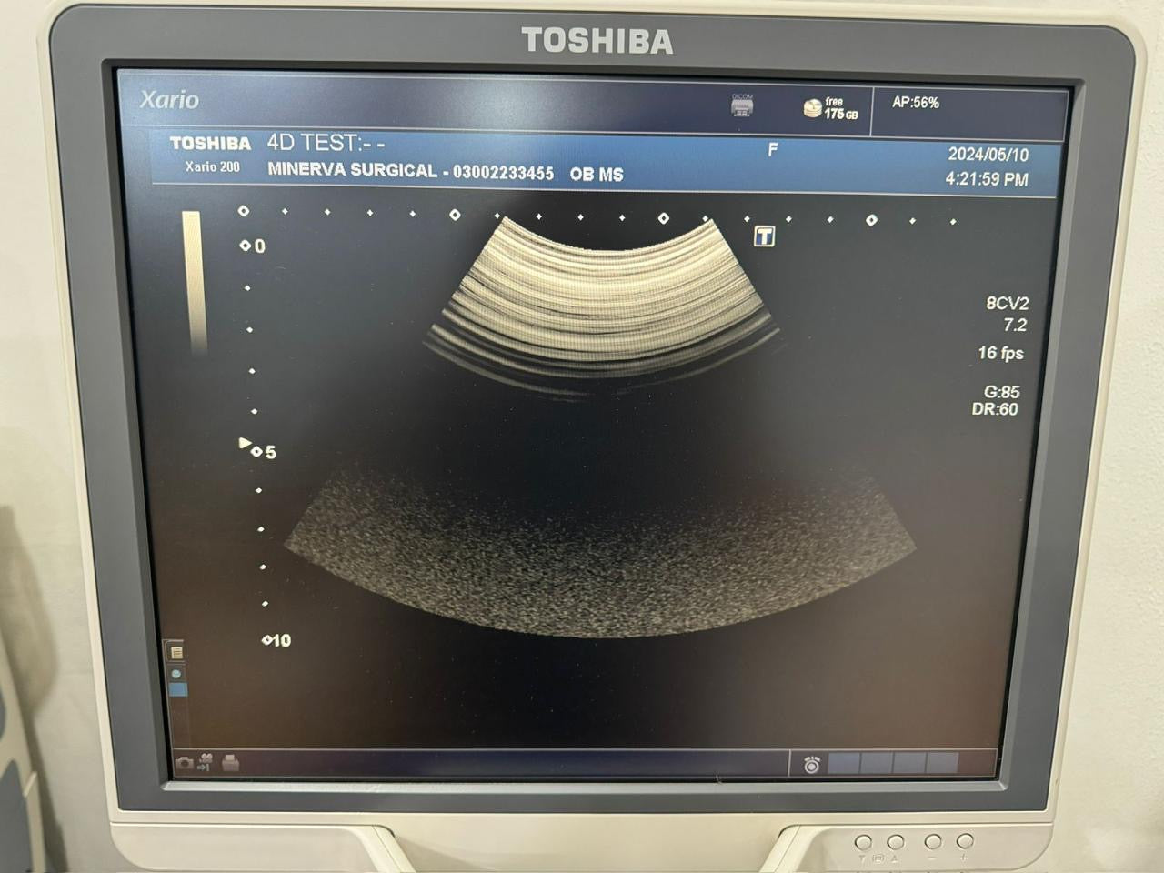 TOSHIBA PVU-674MV / 8CV2
CURVED PROBE