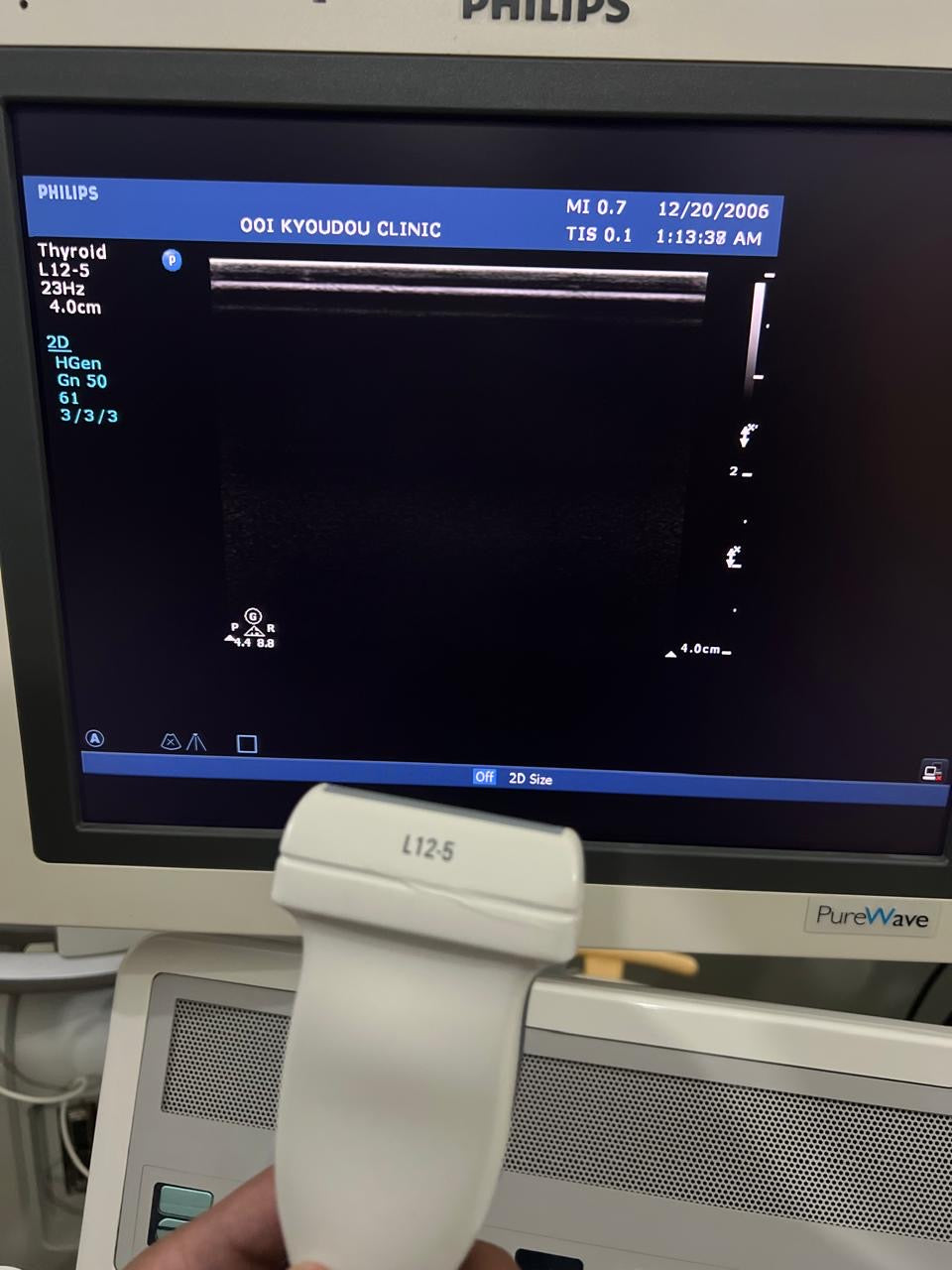 ..Philips L12-5 linear probe