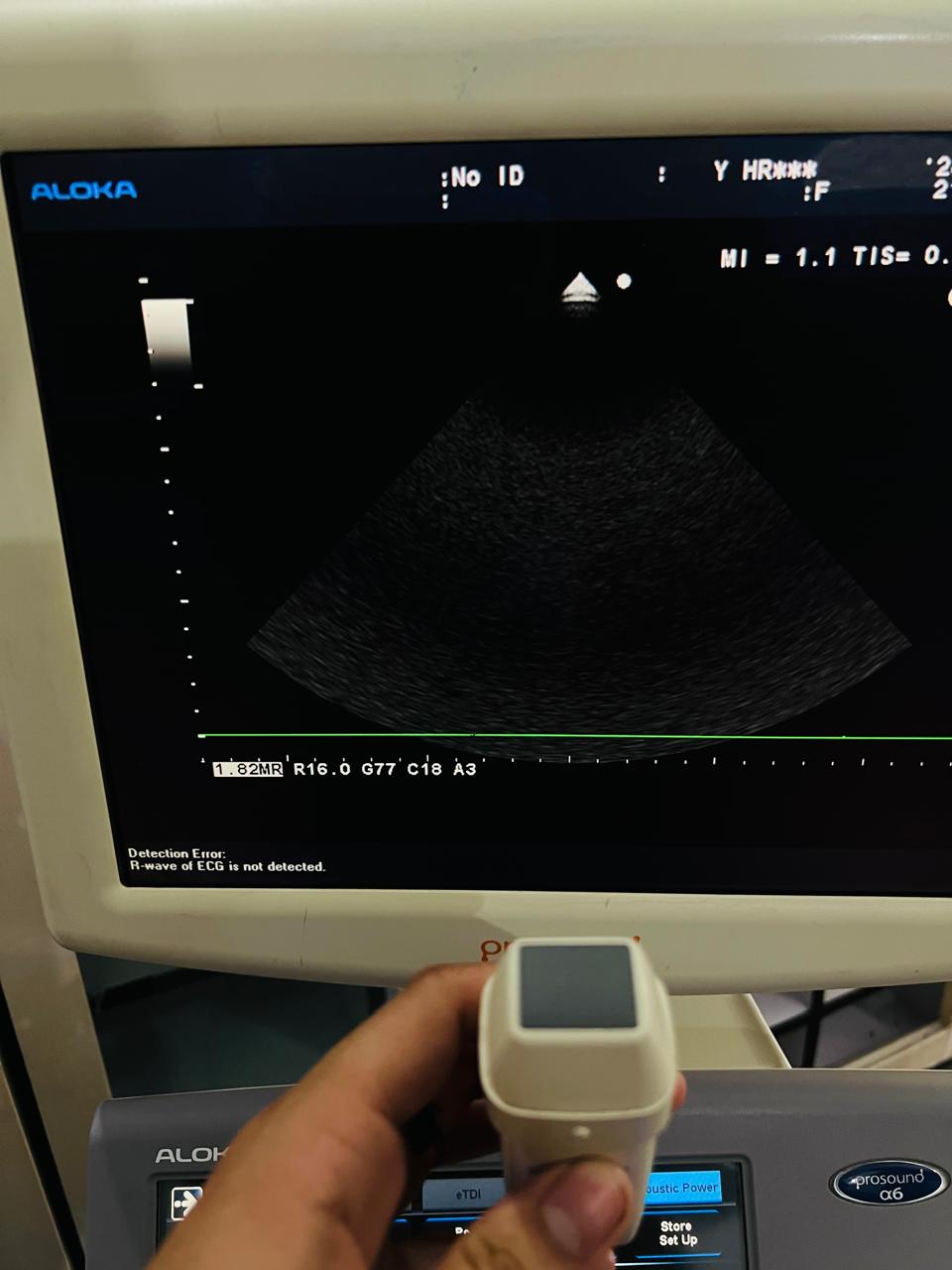 ..Aloka UST-5299 cardiac probe