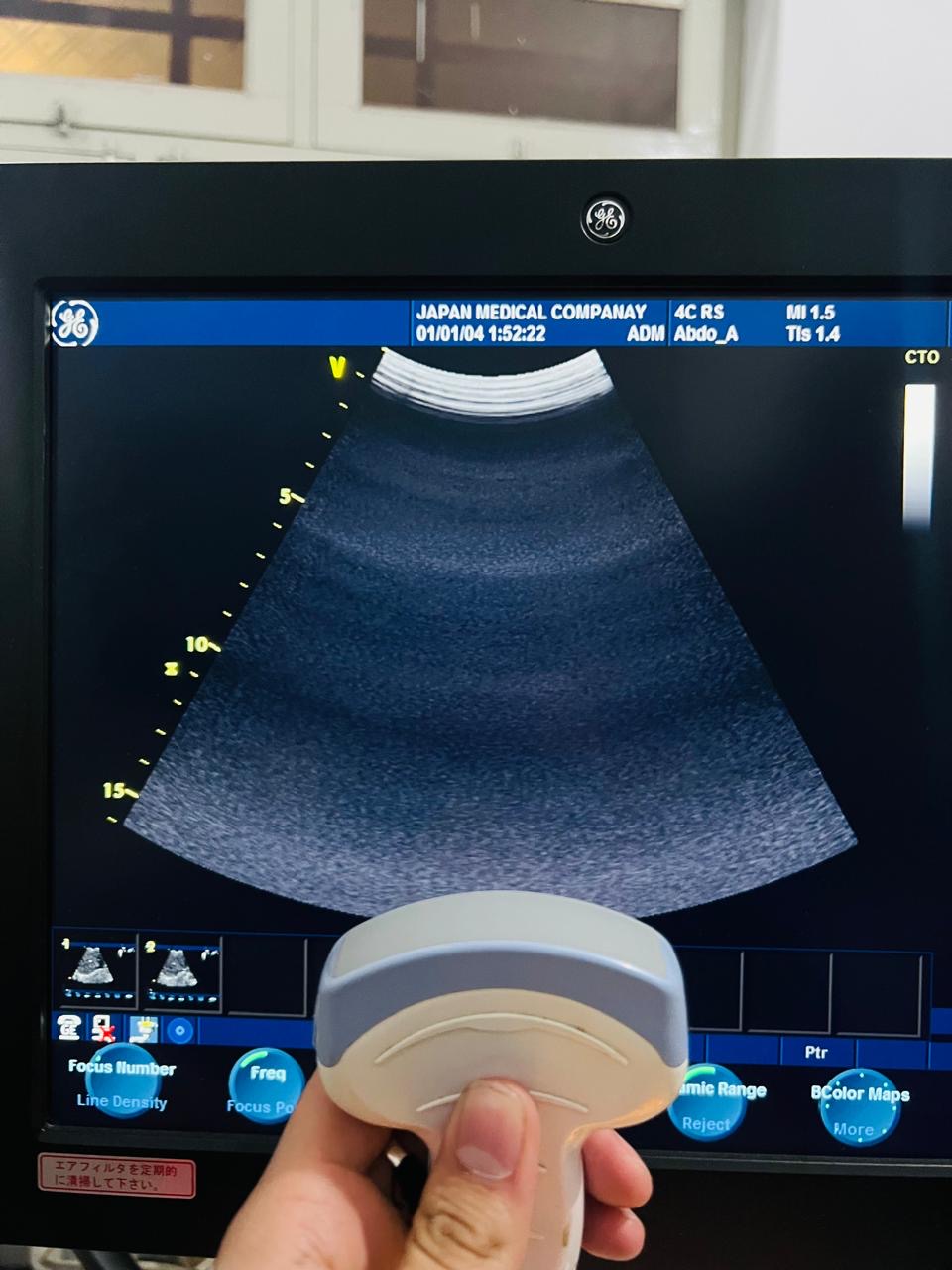 ..GE 4C RS Probe num 8