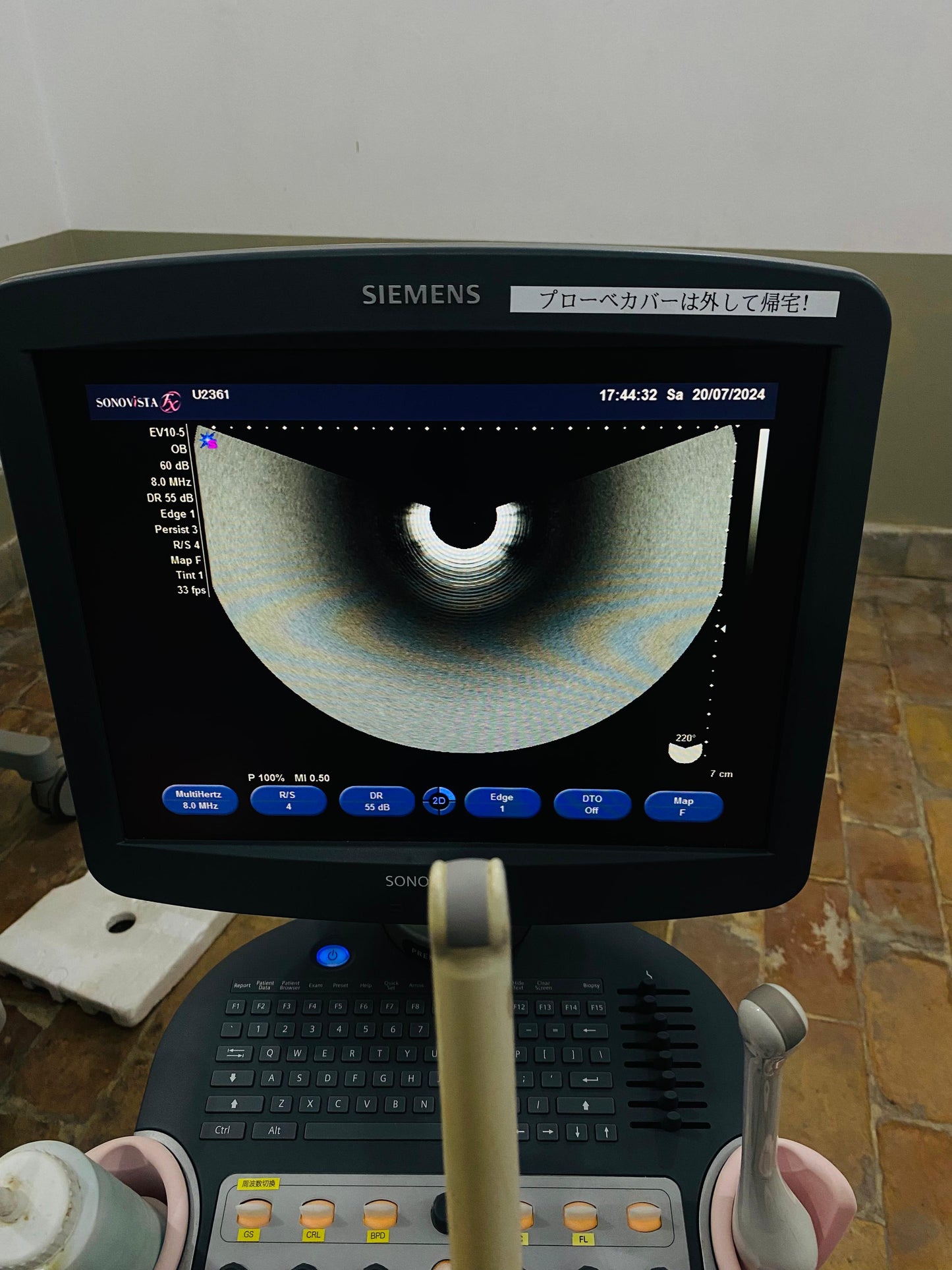 P..Siemens EV10-5 Tvs probe