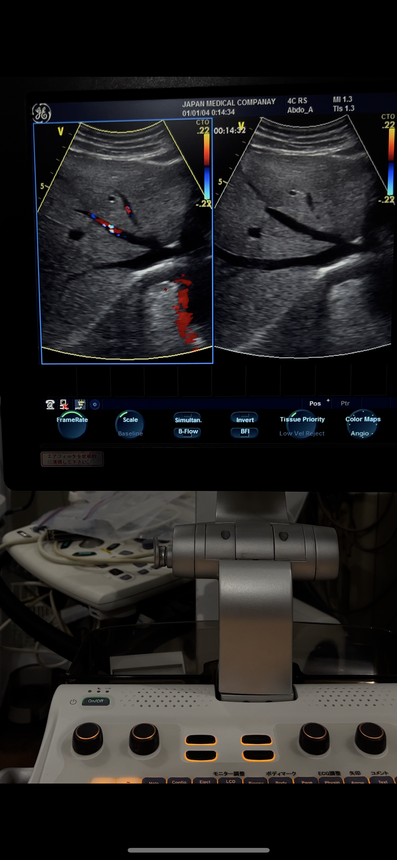 ..GE 4C RS probe num 15