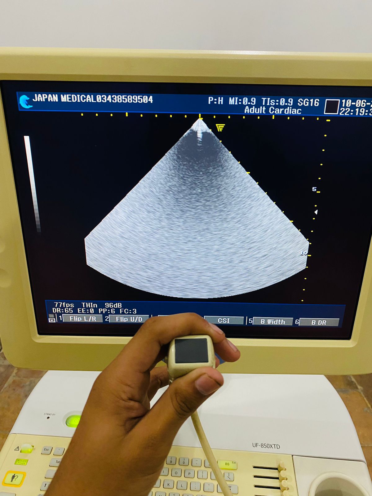 Z…Fukuda Denshi 2-5 cardiac probe