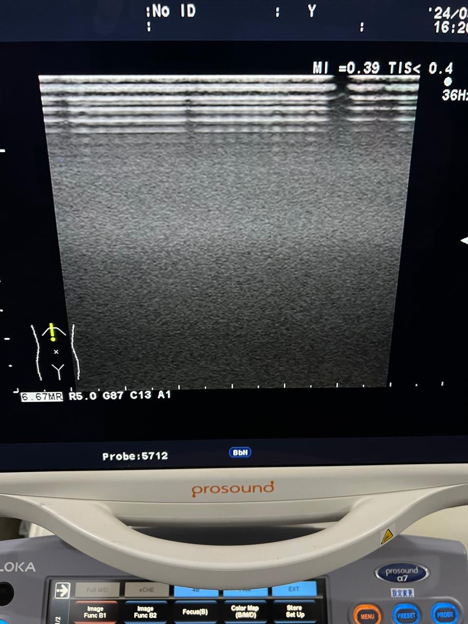 ..Hitachi UST-5712 linear vascular probe - Japan Medical Company LTD