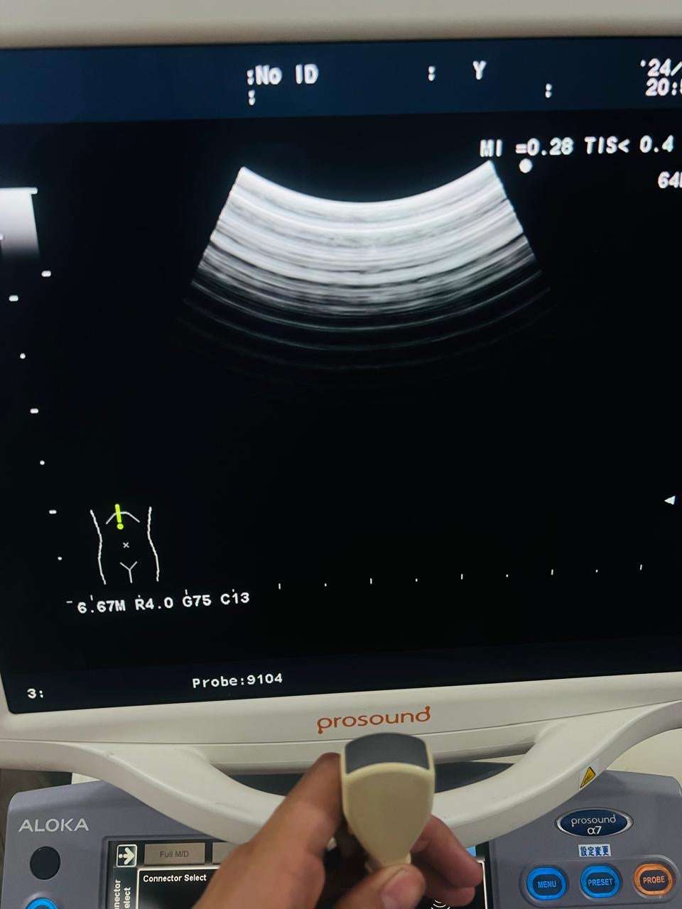 ..Aloka UST-9104-5 micro-convex probe