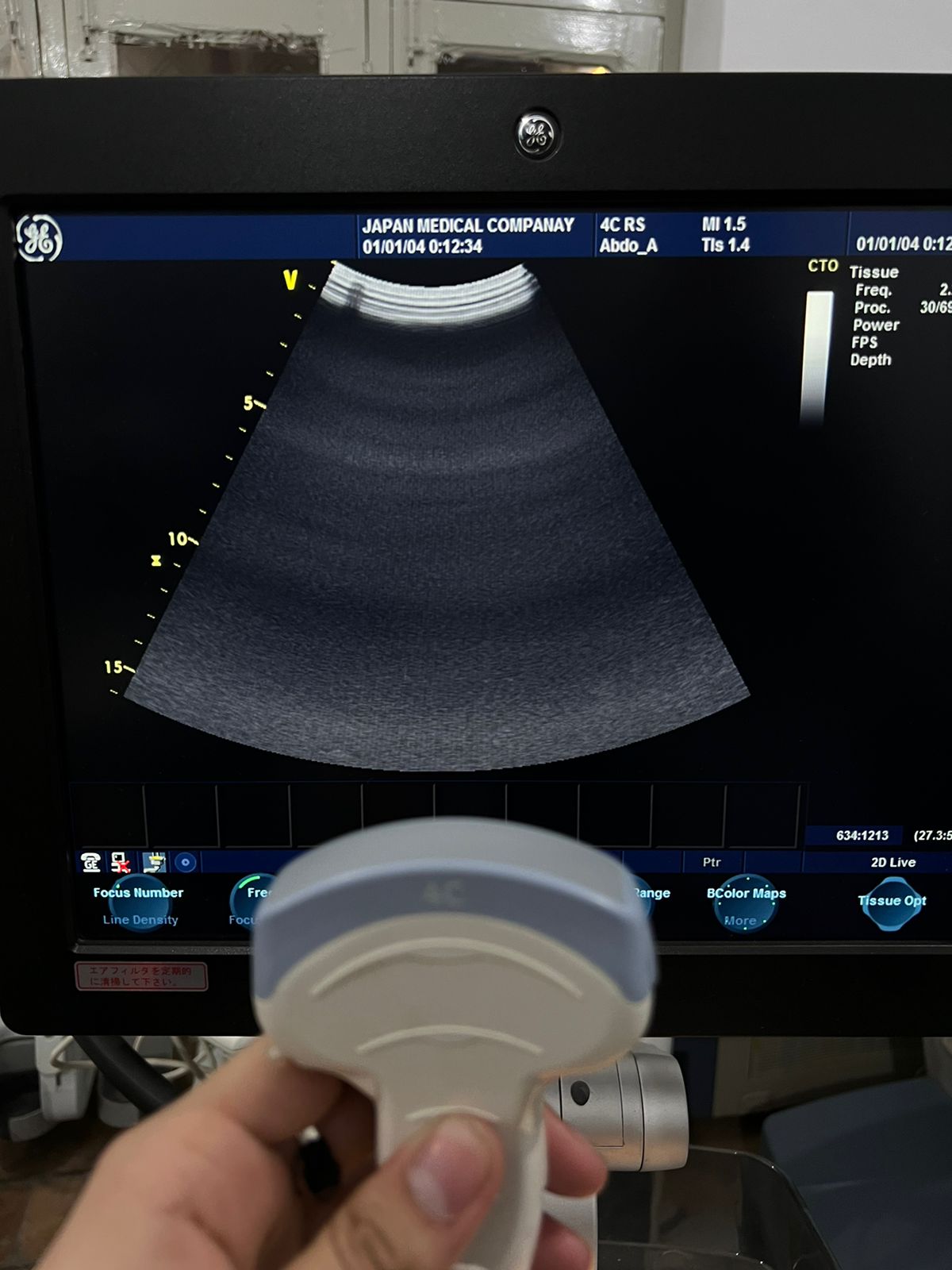 ..GE 4C RS probe num 15