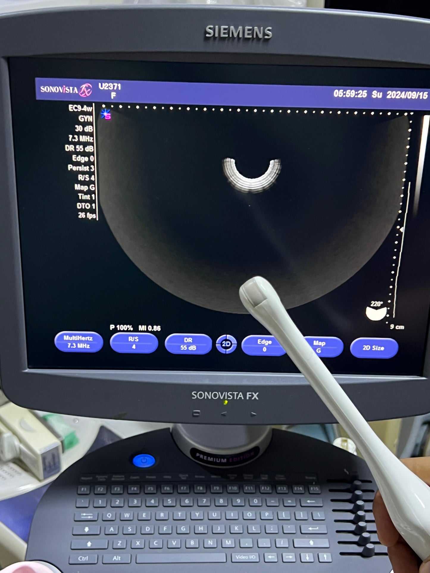 Sonovista FX Premium edition black and white ultrasound with convex tvs probe