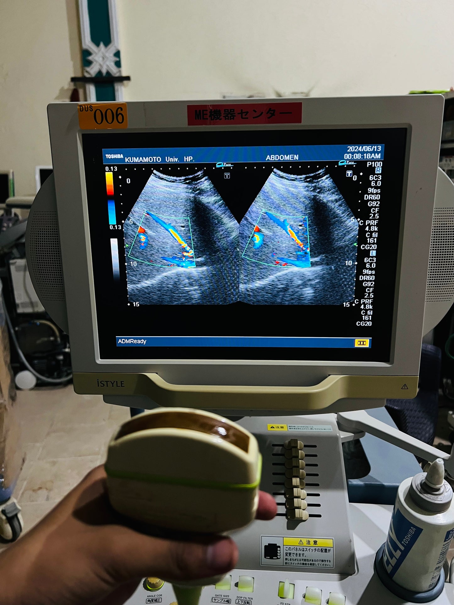 P…Toshiba PVM-375AT convex probe