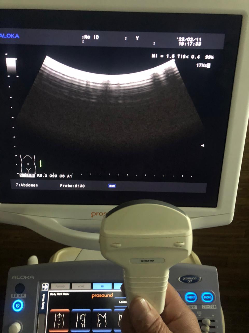 ..Aloka UST-9130 Convex probe - Japan Medical Company LTD