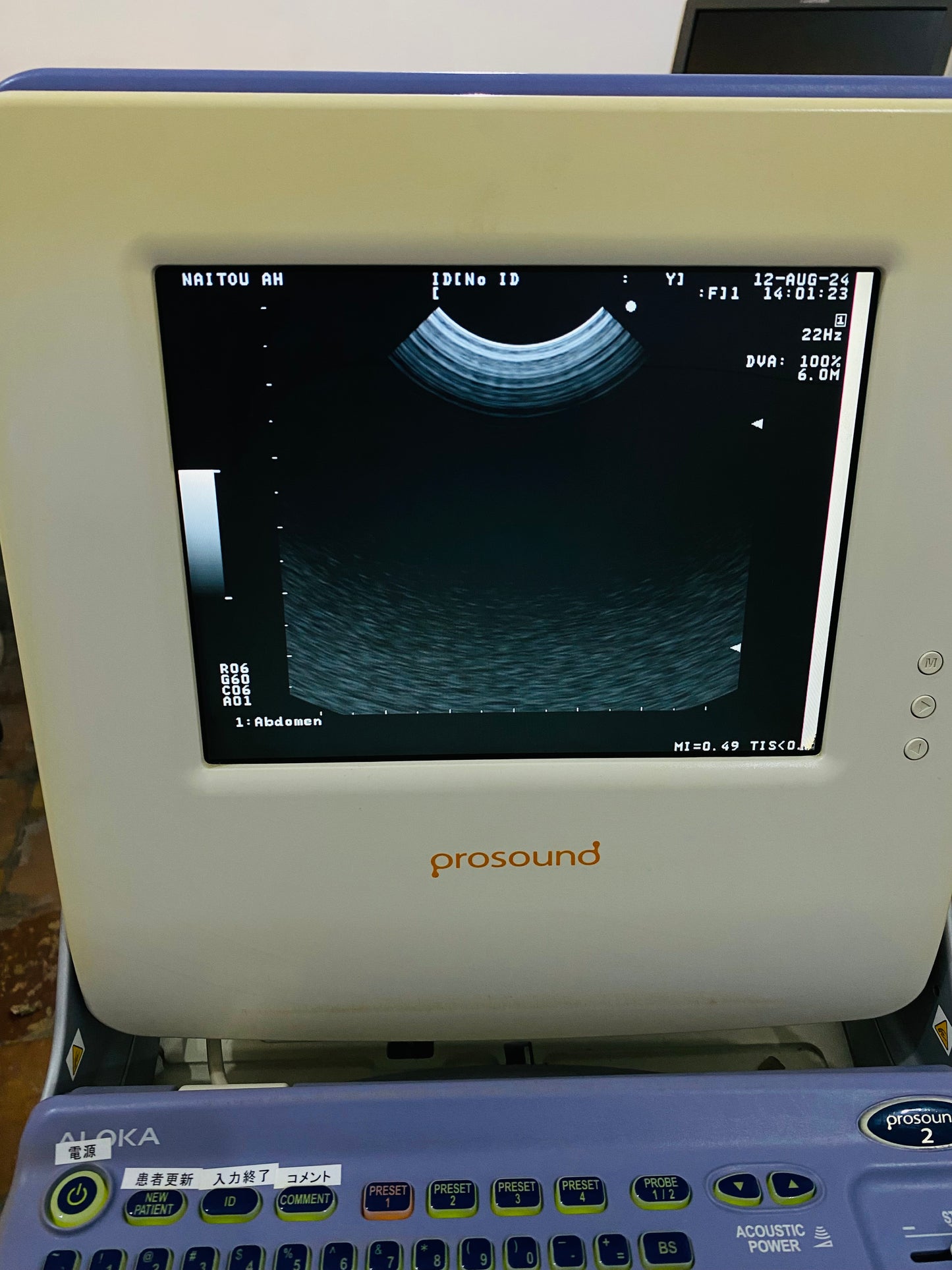 P..Aloka UST-9111-5 Micro convex probe