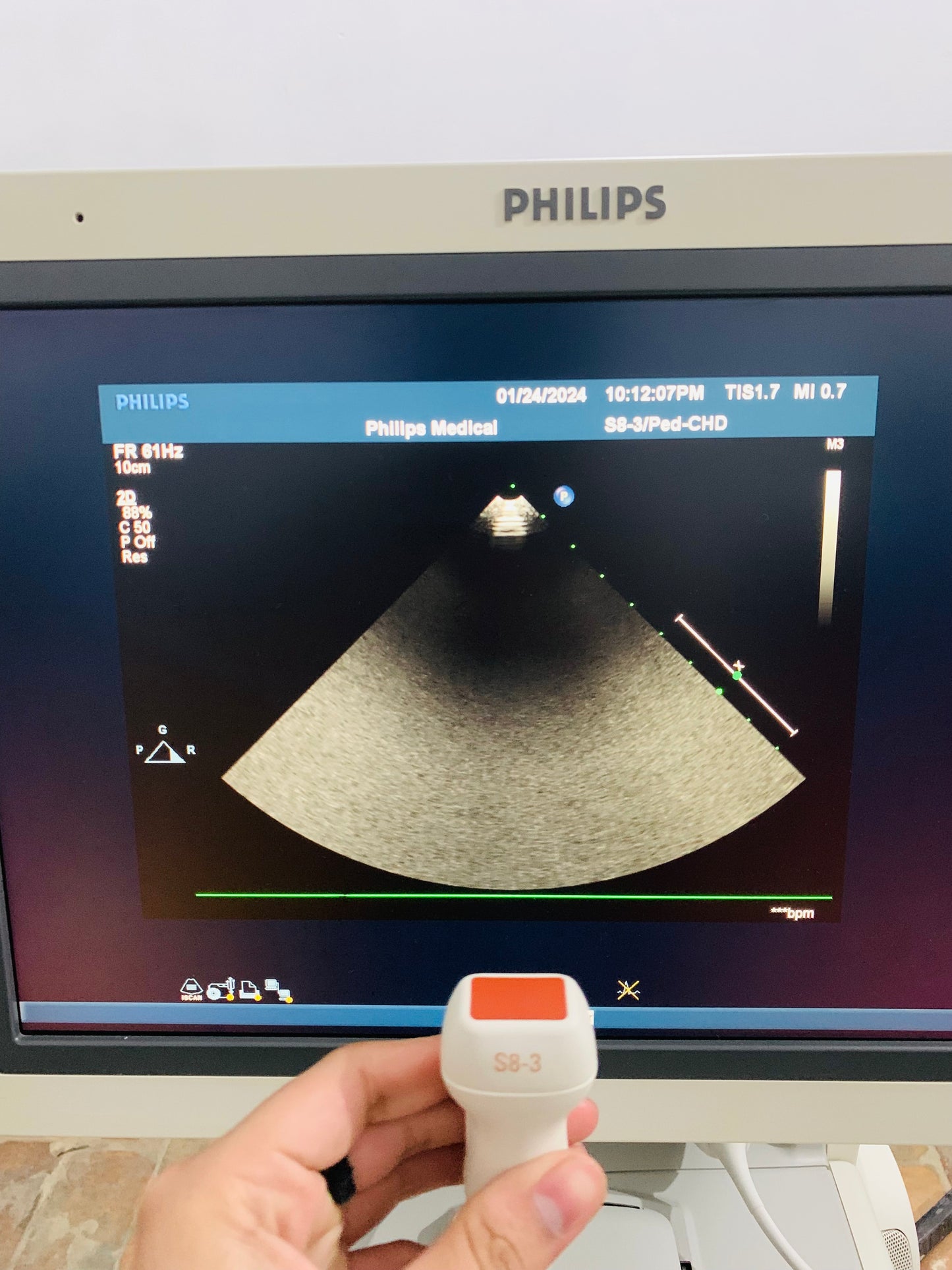 Philips IE 33 Ultrasound Machine