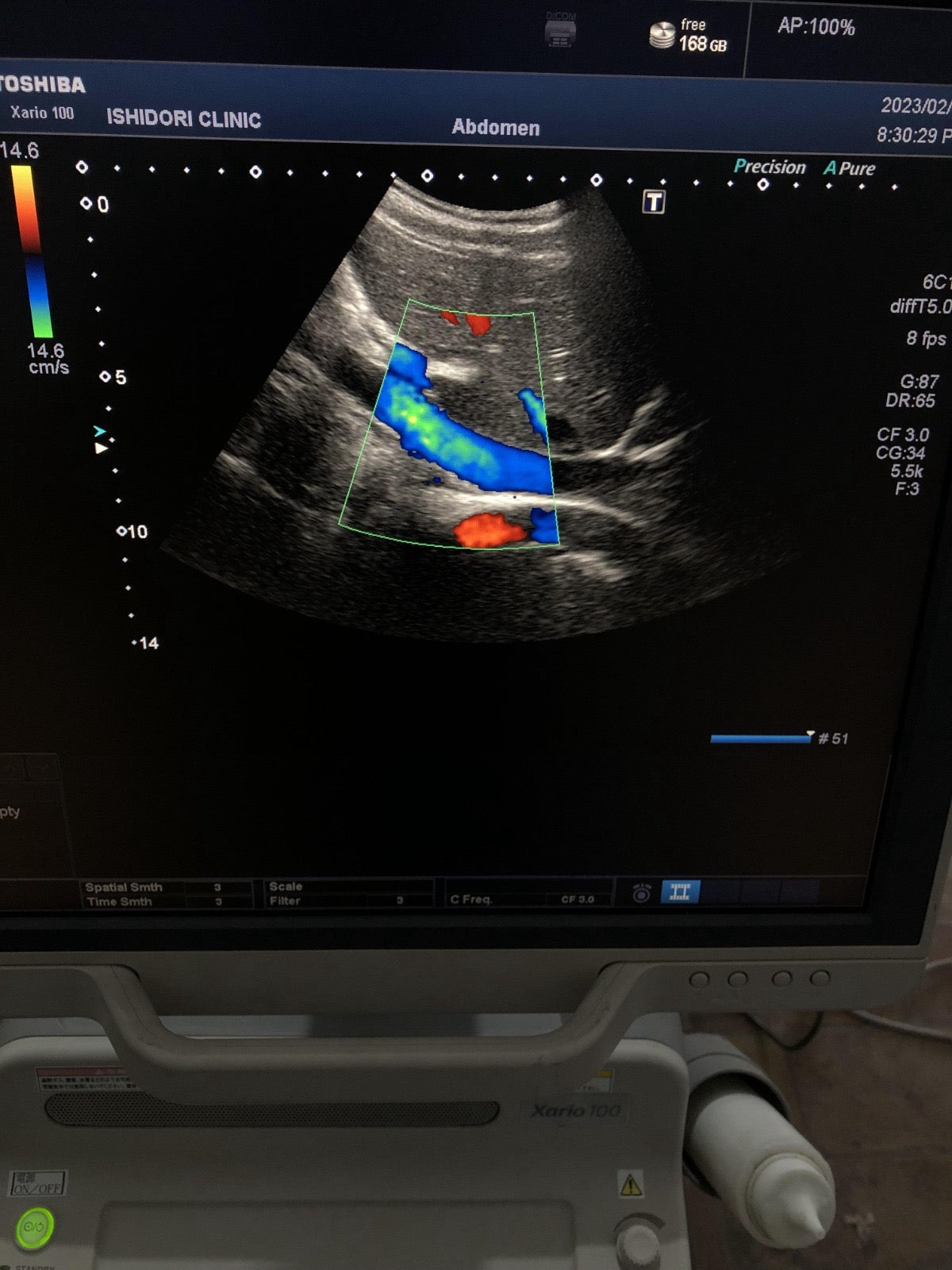 Toshiba PVU-375BT canvex probe - Japan Medical Company LTD
