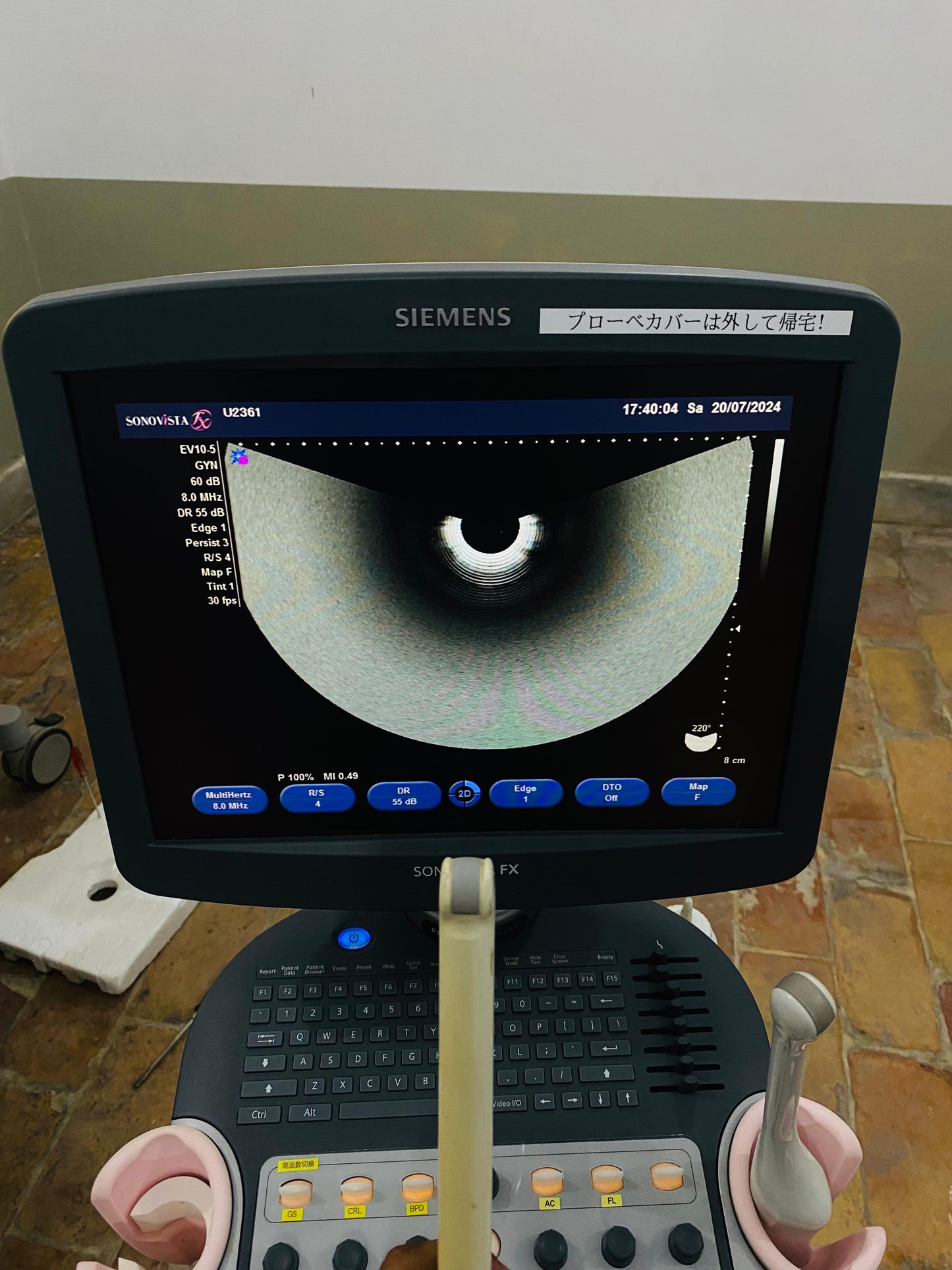 P..Siemens EV10-5 Tvs probe