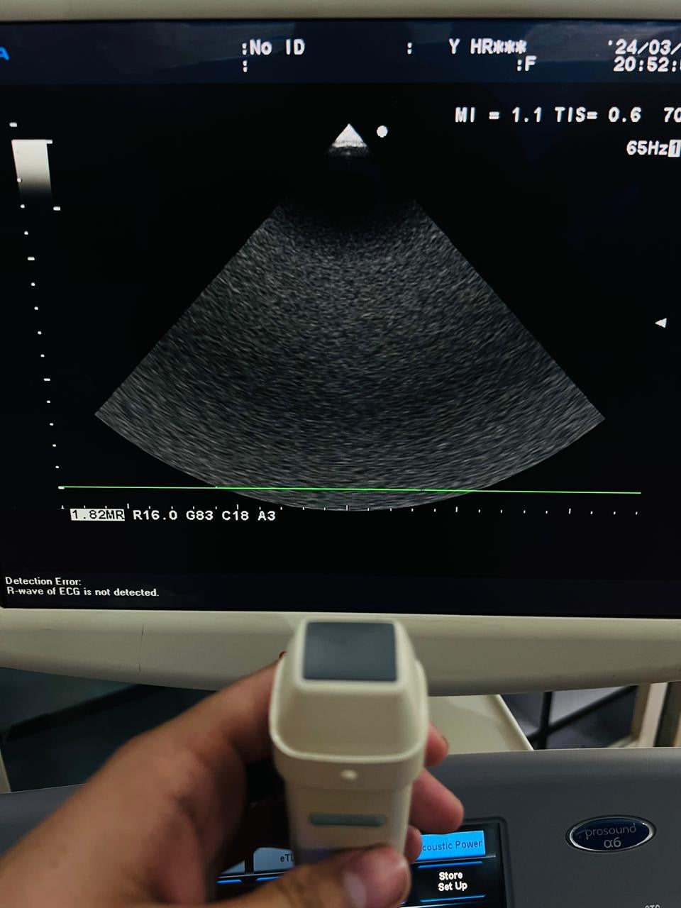 ..Aloka UST-5299 cardiac probe