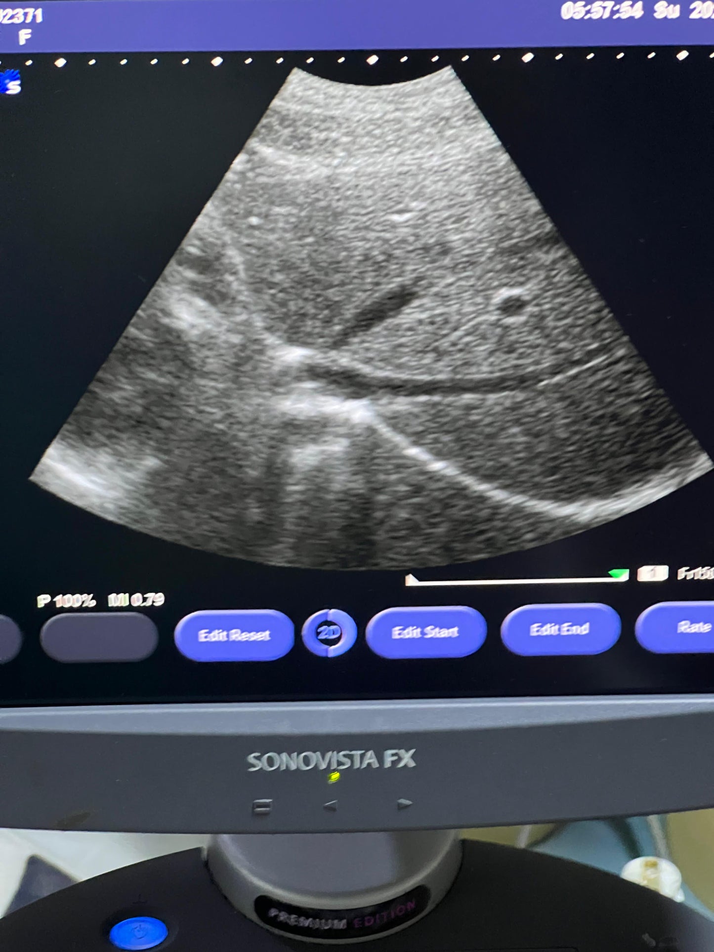 Sonovista FX Premium edition black and white ultrasound with convex tvs probe