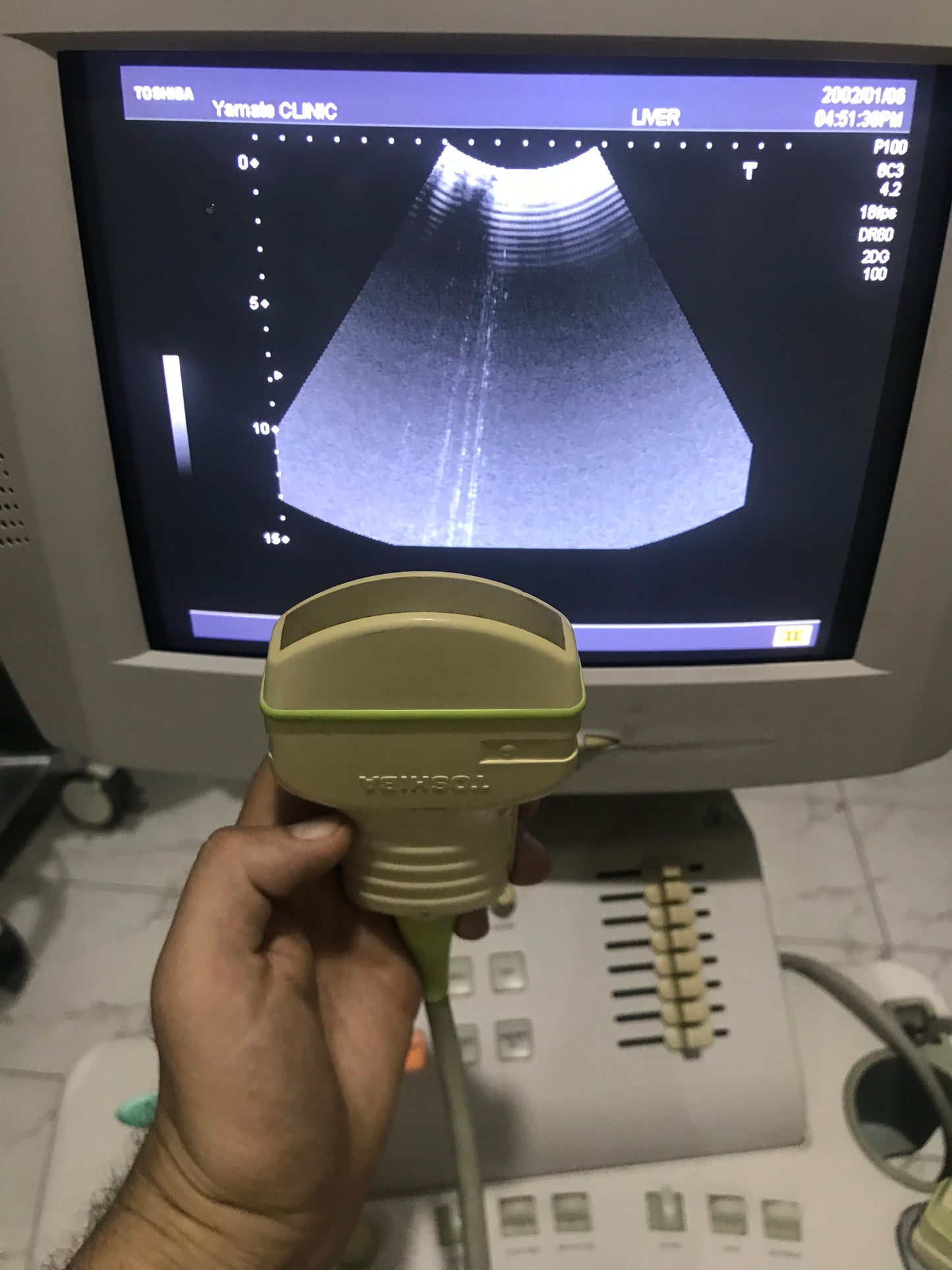 ..Toshiba PVM-375AT canvex probe - Japan Medical Company LTD
