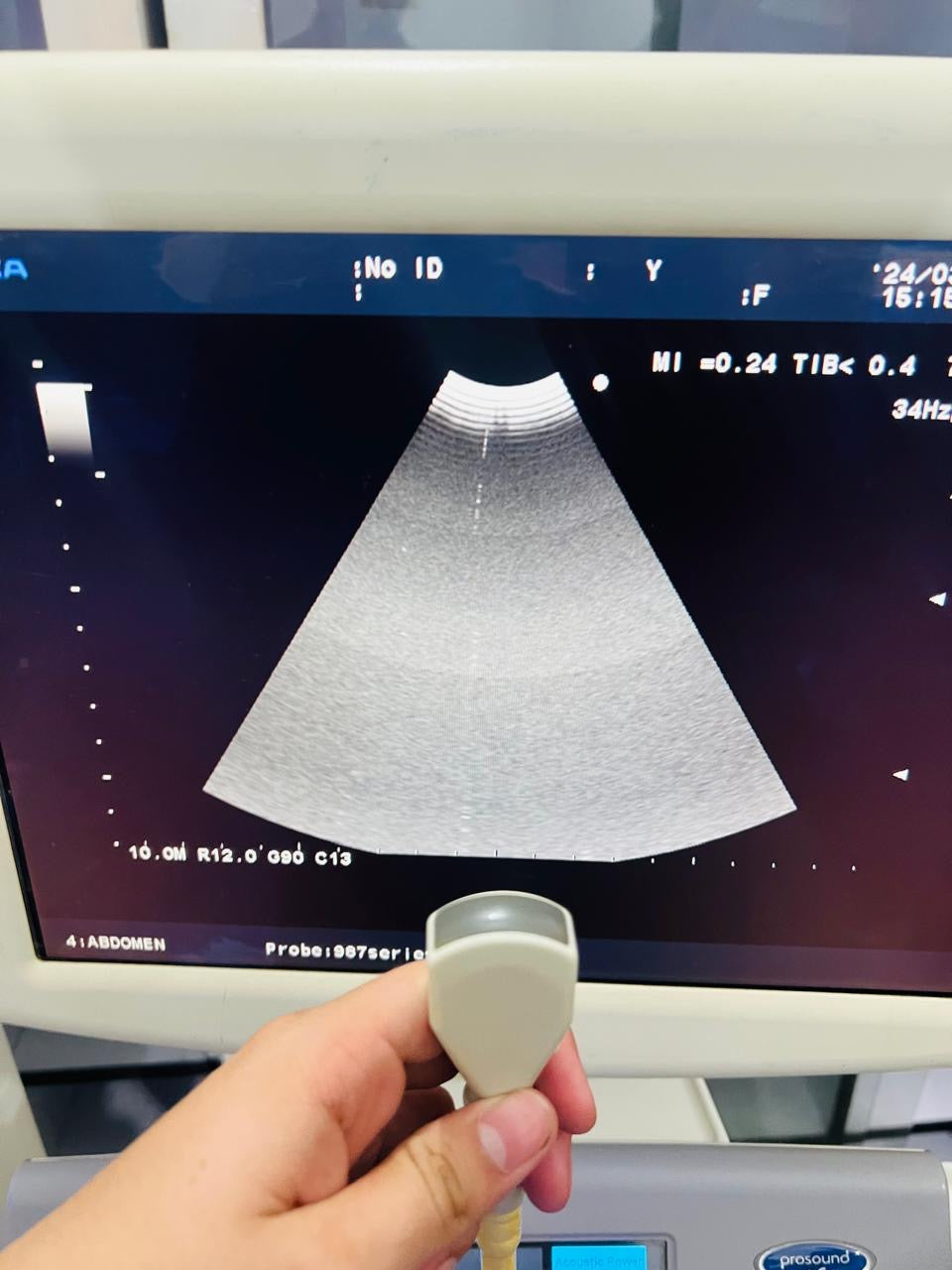 ..Aloka UST-987-7.5 Microconvex probe