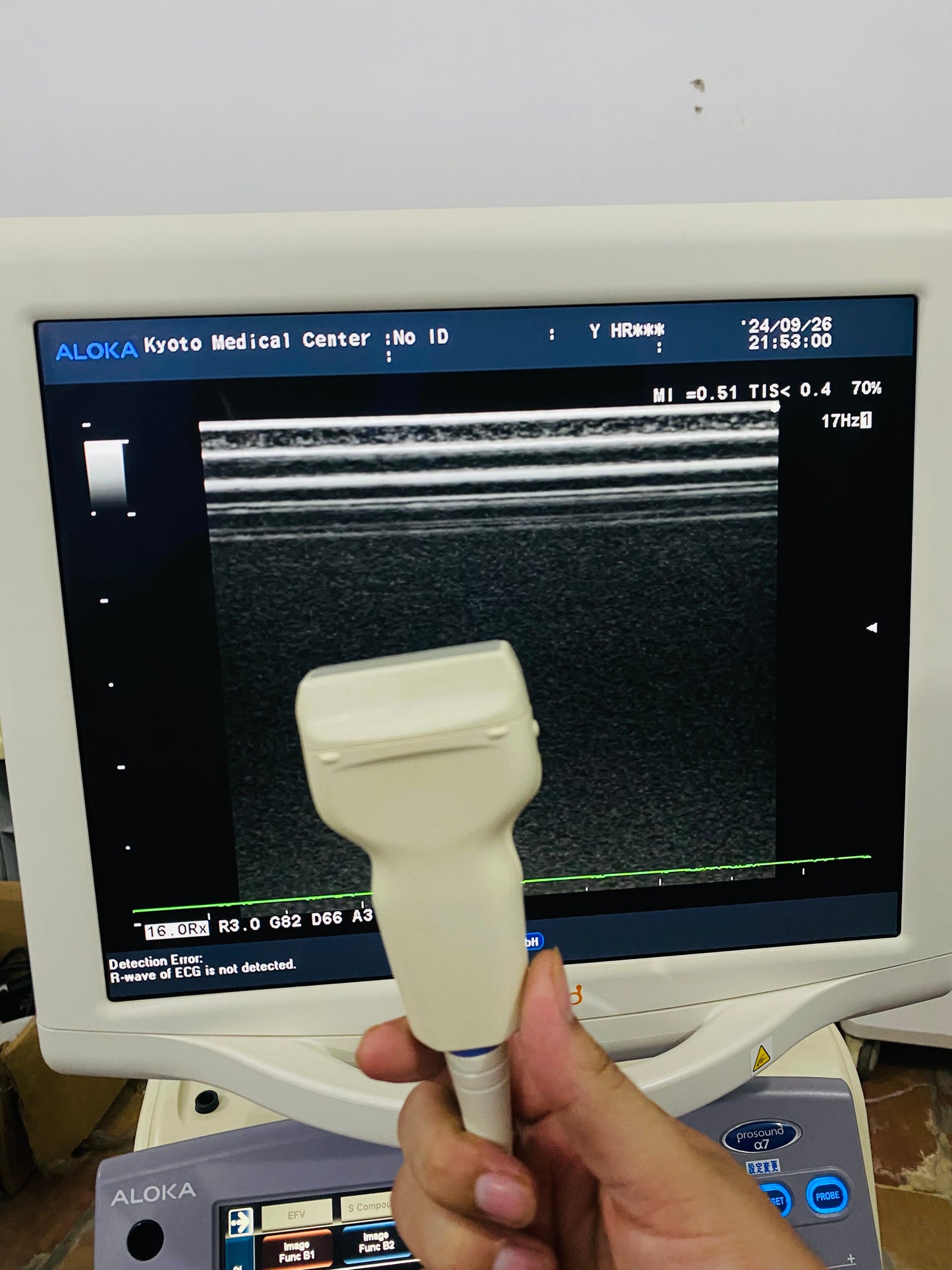 P..Aloka UST-5412 linear probe