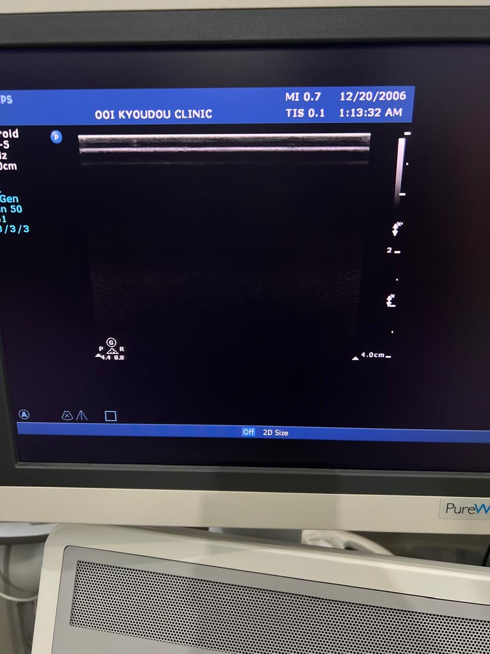 ..Philips L12-5 linear probe