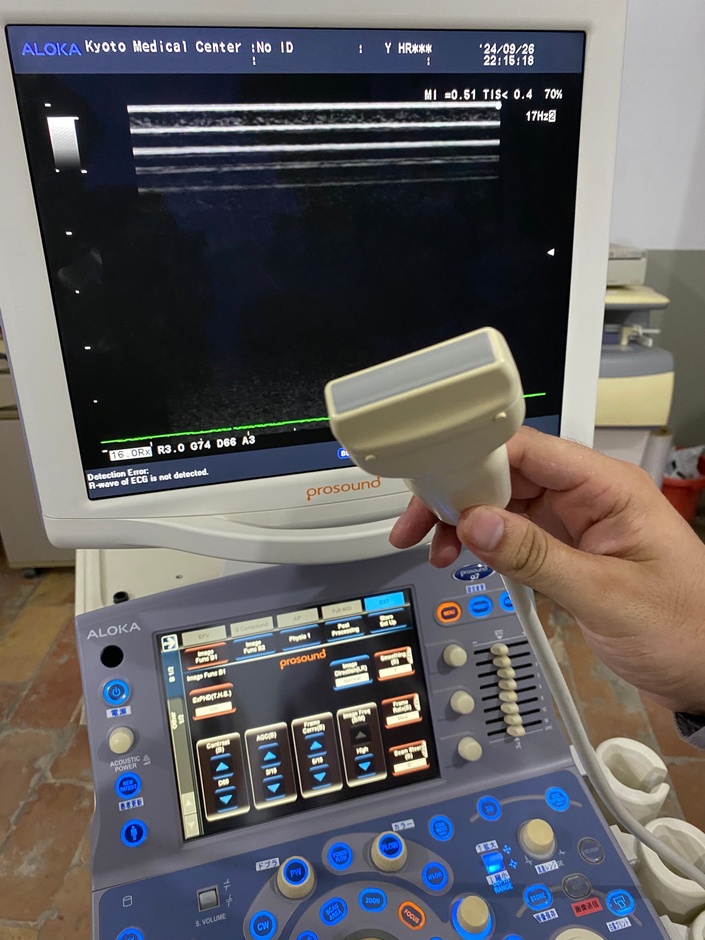 P..Aloka UST-5412 linear probe